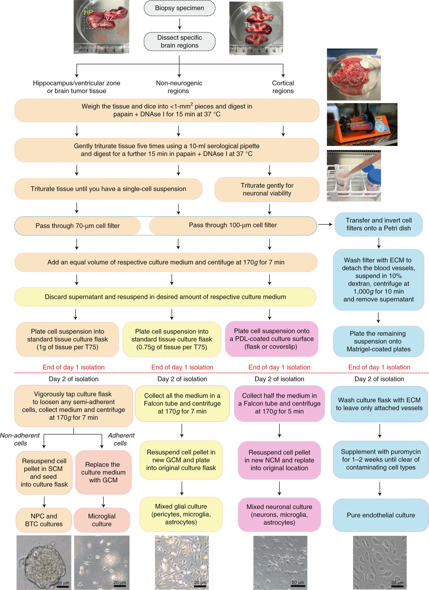 Fig. 1: Flow diagram of the step-by-step procedures in isolating neurons, brain endothelia, NPCs, microglia, mixed glia (astrocytes, microglia and pericytes) and brain tumor cells from post-operative brain specimens.