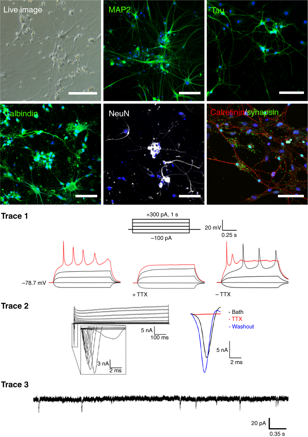 Fig. 2: Photomicrographs and electrophysiological recordings demonstrating the presence of mature primary adult human neurons in vitro.