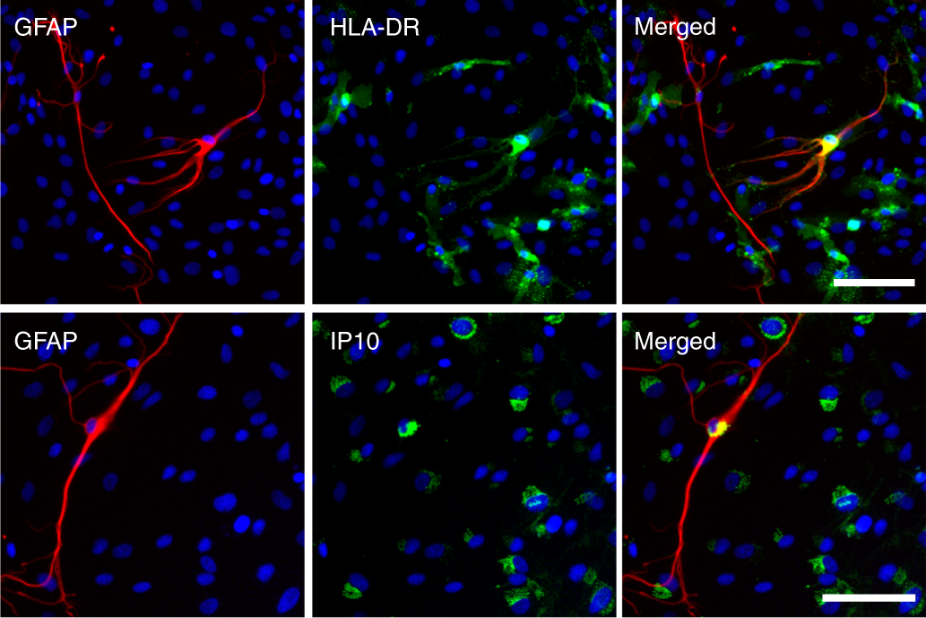 Fig. 3: Photomicrographs showing the presence of GFAP-positive astrocytes and their response to inflammatory stimuli.