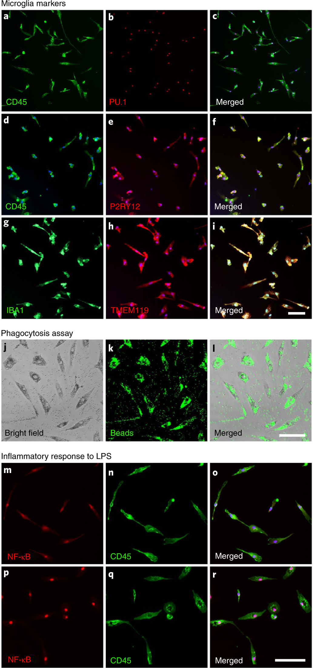 Fig. 4: Photomicrographs showing purified microglia expressing microglia markers and responding to pro-inflammatory cytokines.