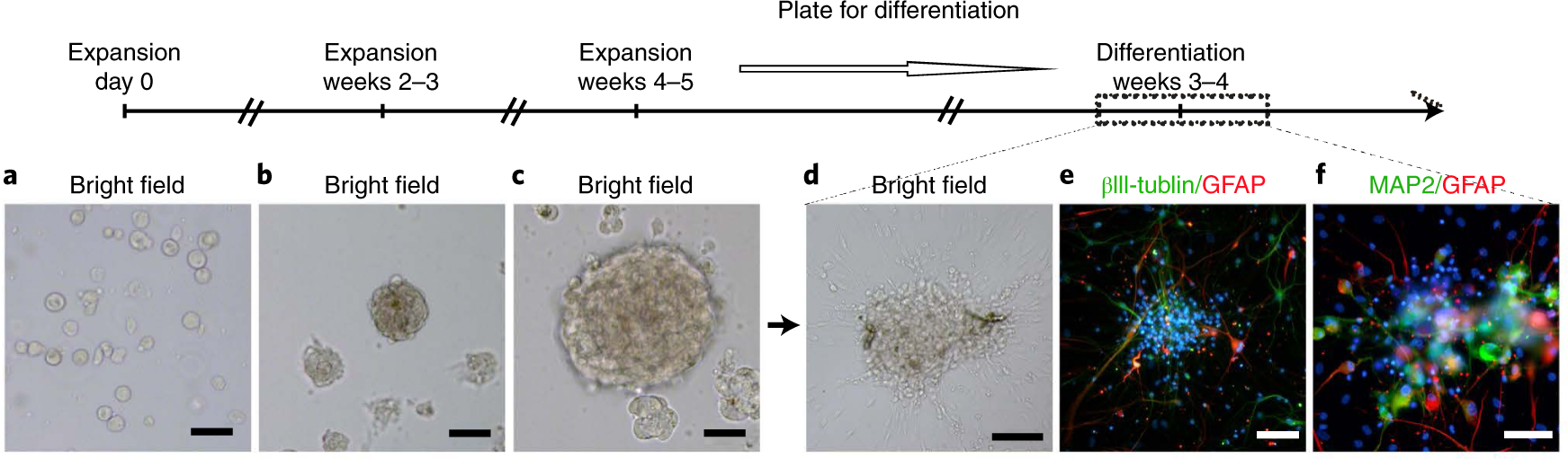 Fig. 6: A timeline and representative figures showing the isolation, expansion and differentiation of primary adult human neural progenitor cells in vitro.