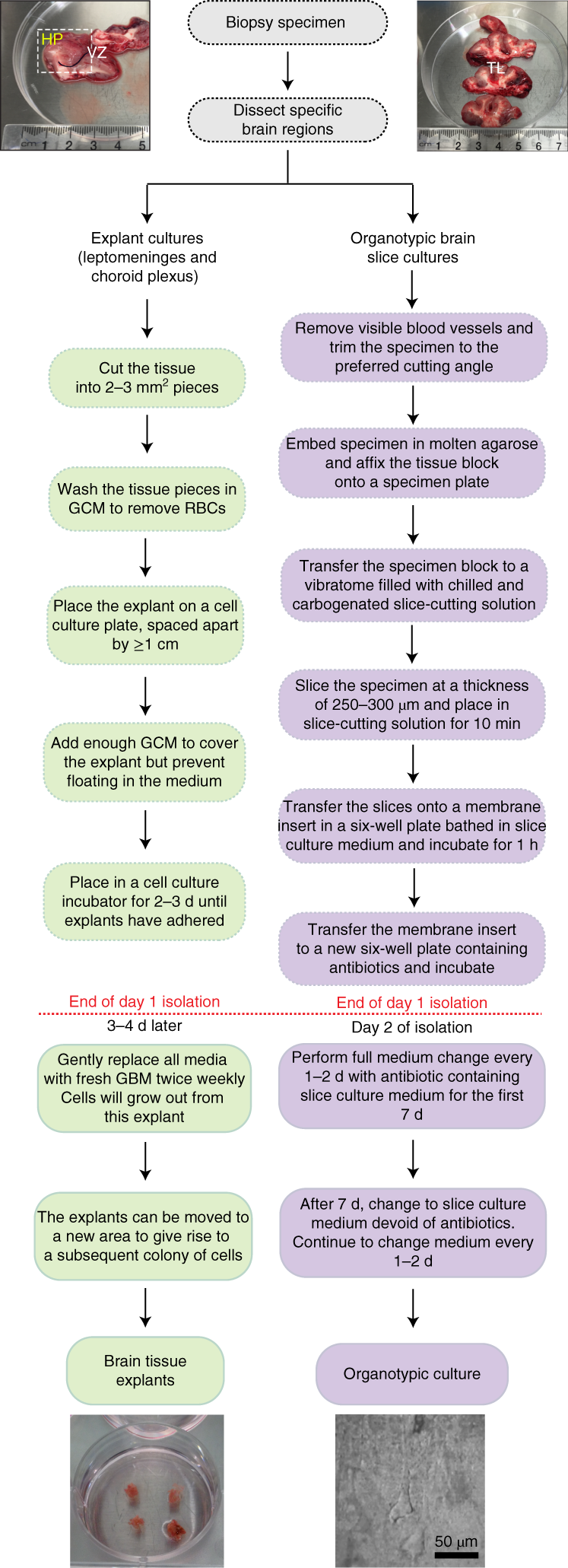 Fig. 8: Flow diagram of the step-by-step procedure for processing organotypic brain slice and explant cultures from post-operative human brain specimens and the leptomeninges.