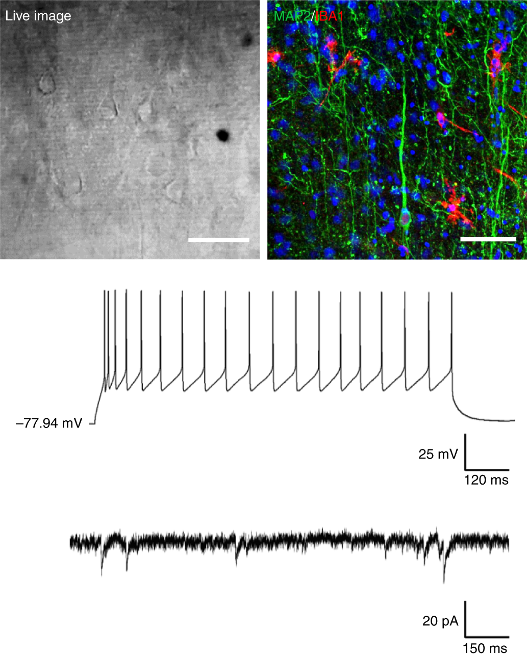 Fig. 9: Photomicrographs and electrophysiological recordings demonstrating the presence of viable and functional adult human brain slice cultures.