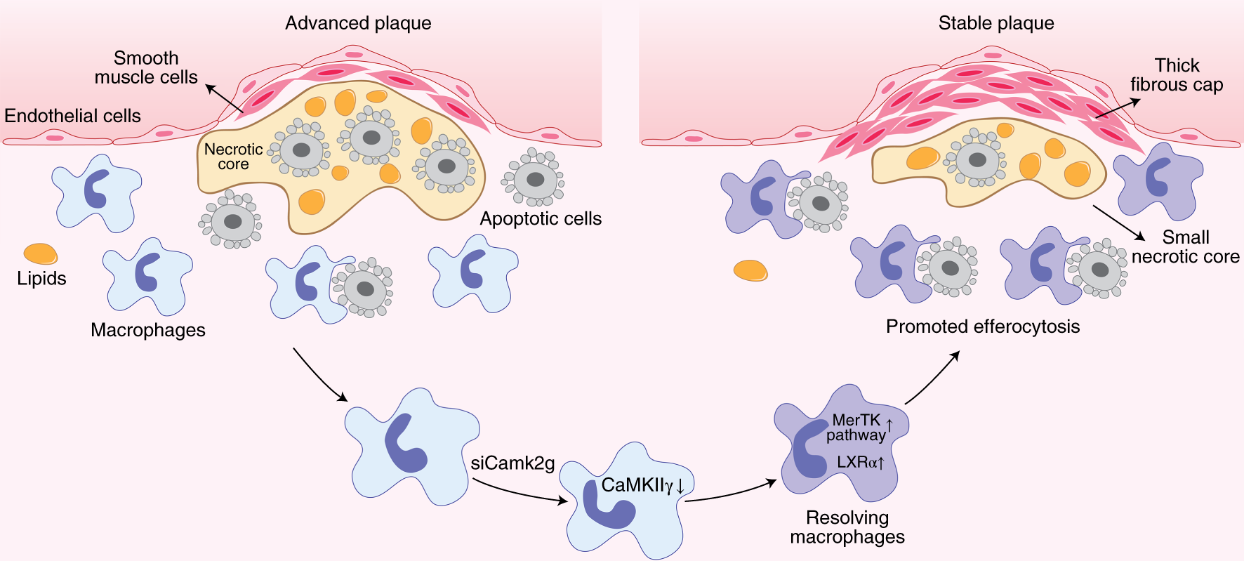 Fig. 1: Schematic of CaMKIIγ-mediated plaque stability.