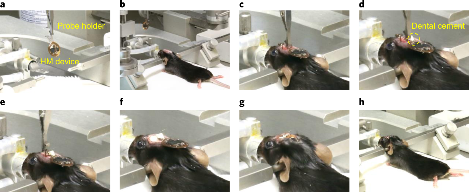 Fig. 8: Implantation procedures for active HM devices.