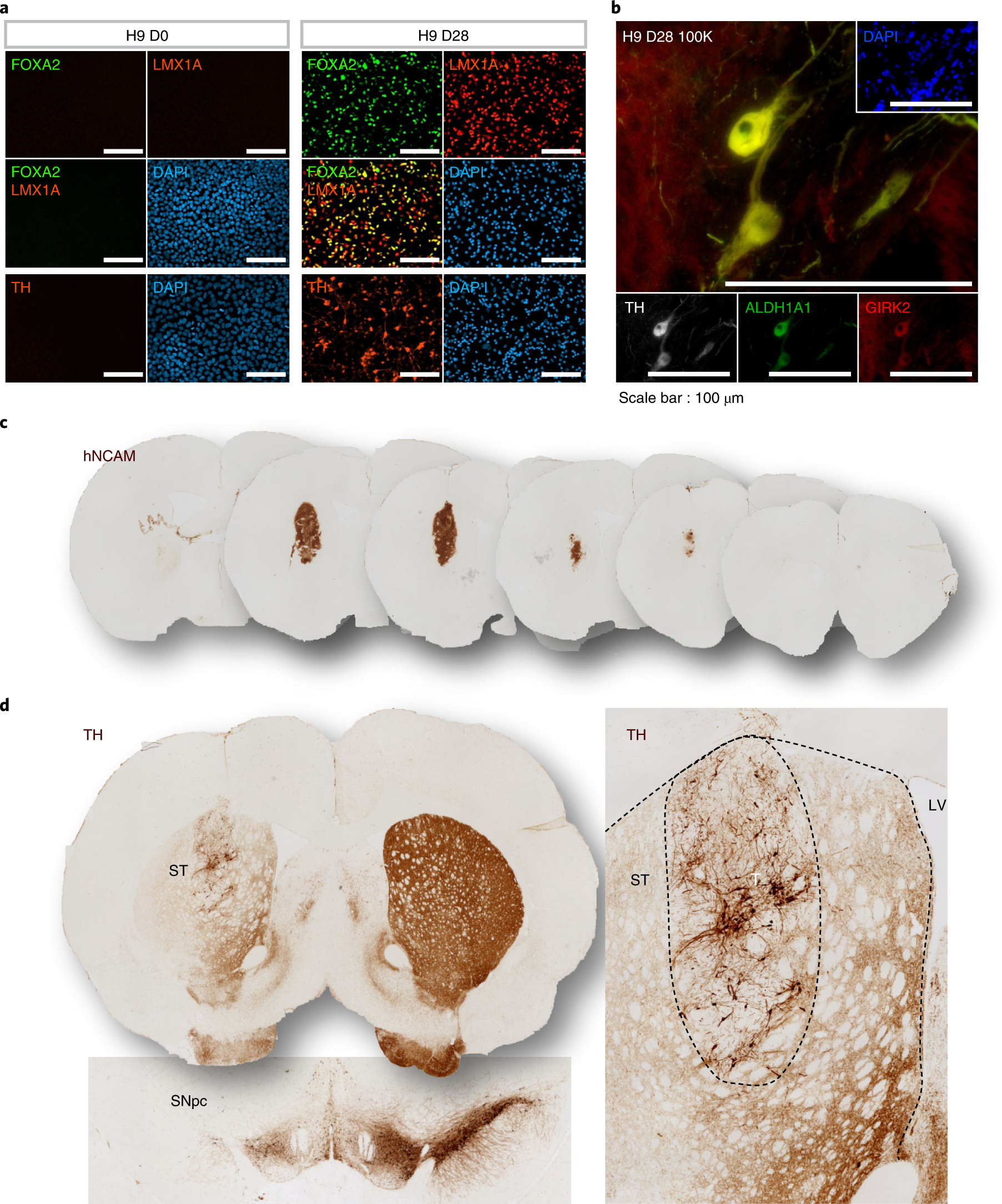 Fig. 5: Characterization of mDA cells differentiated from hESCs (H9) in vitro and in vivo.