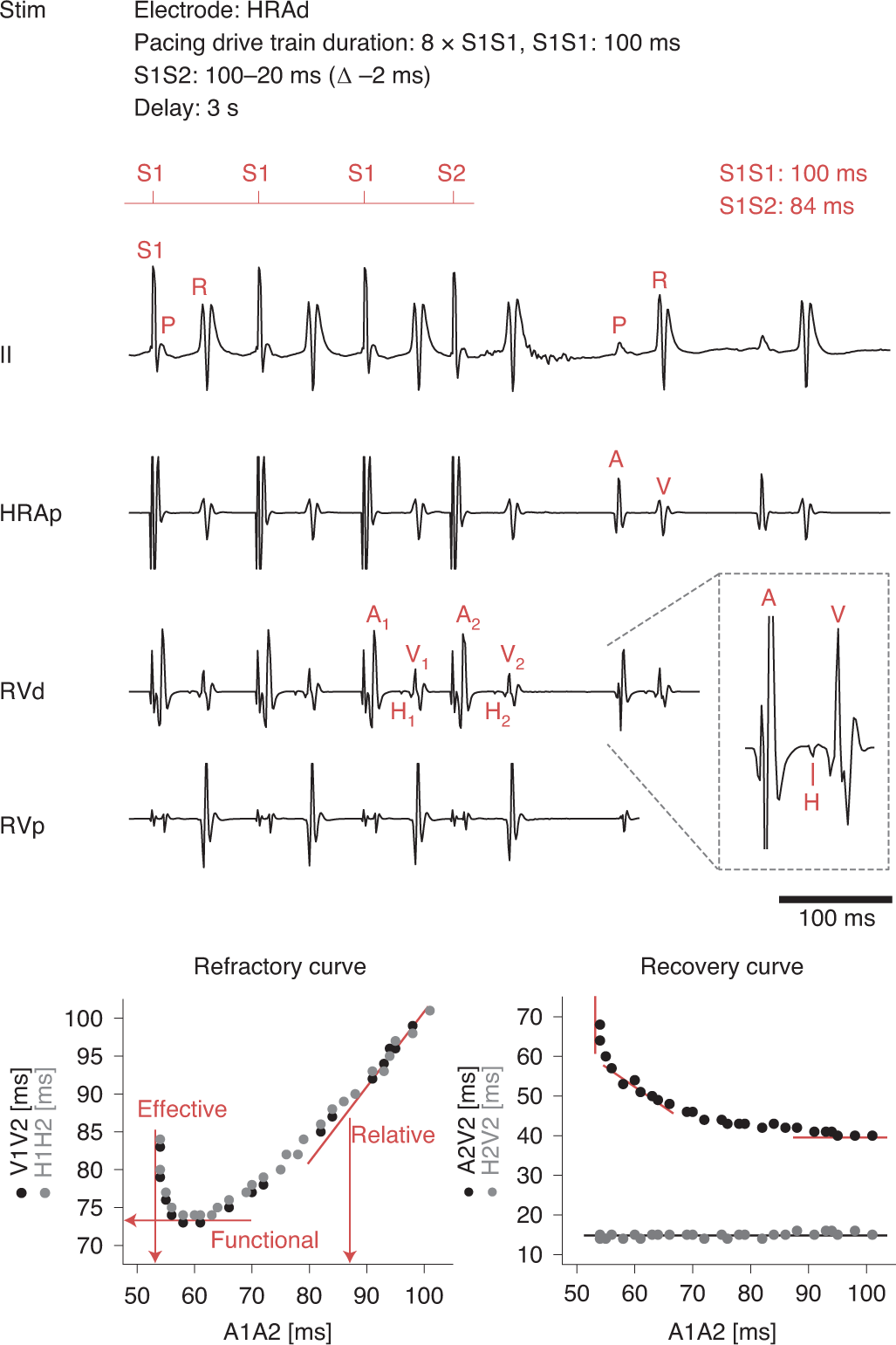 Fig. 10: AV nodal recovery and refractory curves.