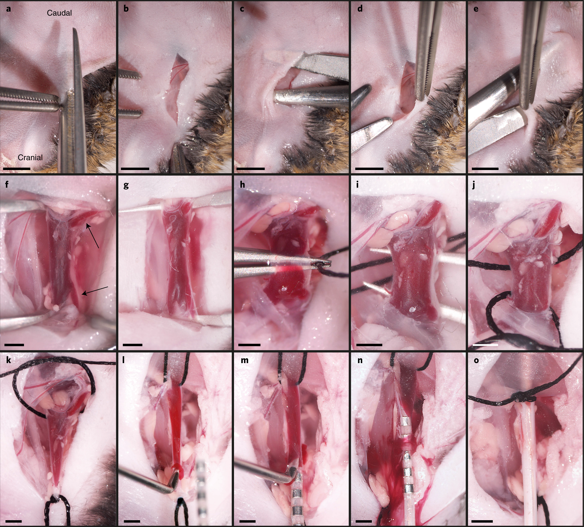 Fig. 2: Catheter placement.