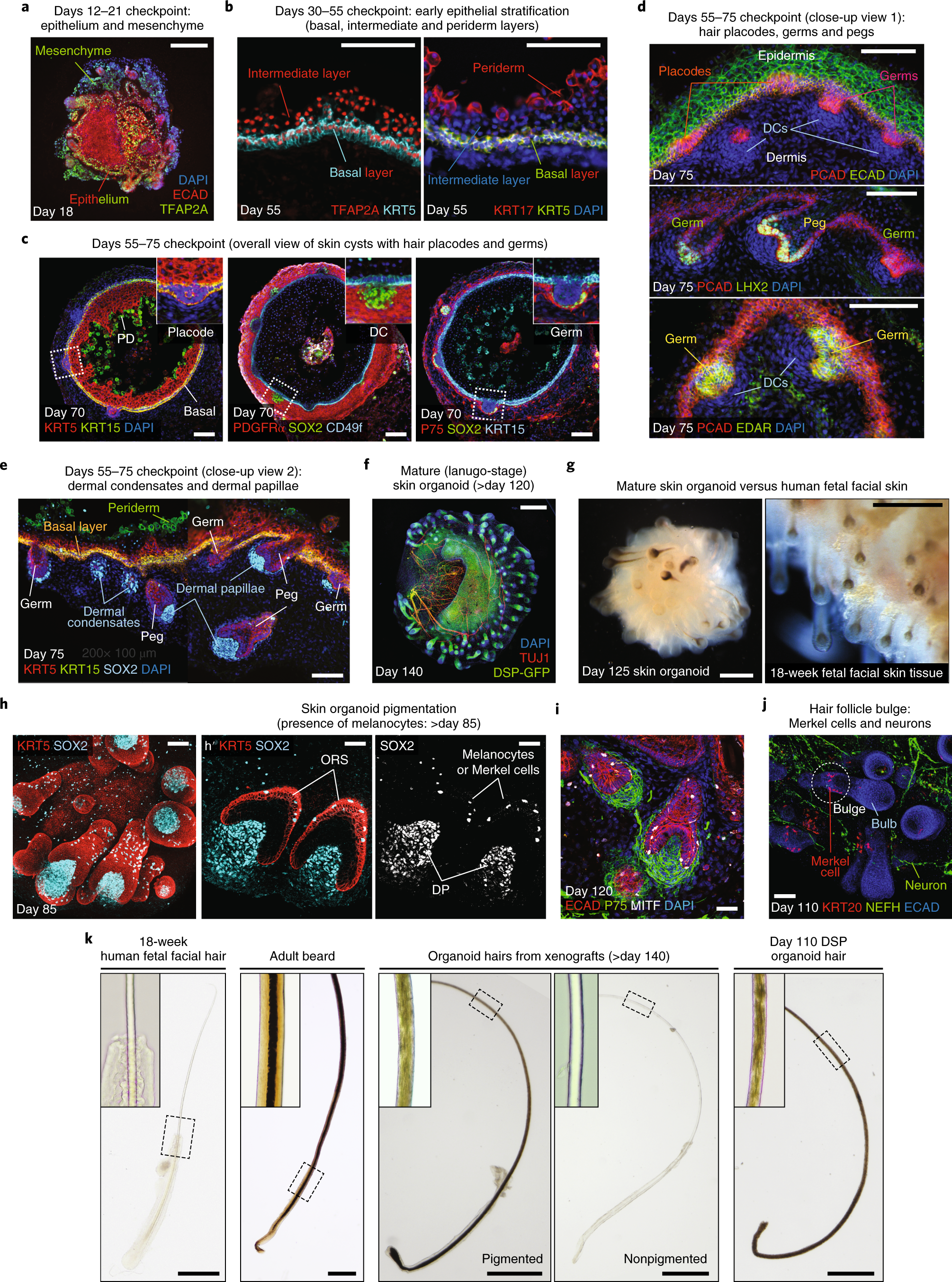 Fig. 3: Images from optimal timepoints to check differentiation and characterization of the resulting skin organoids structure.
