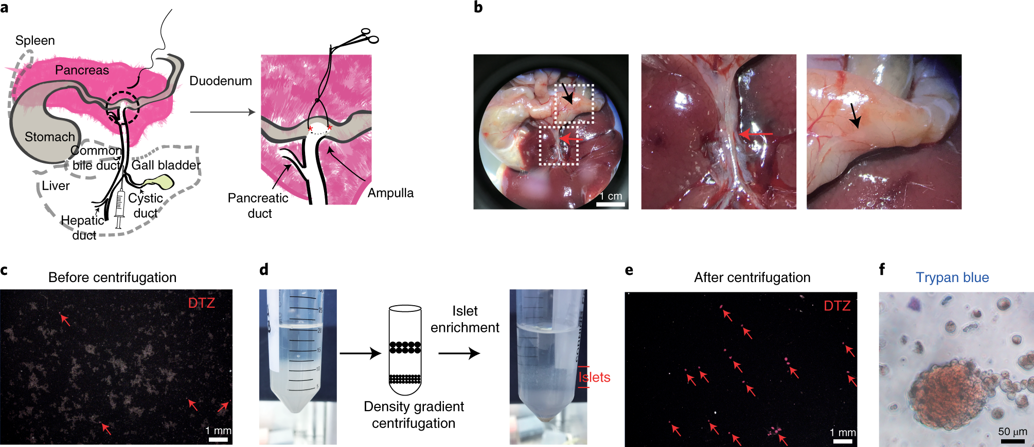 Fig. 3: Pancreas perfusion and islet purification by density gradient centrifugation and handpicking.