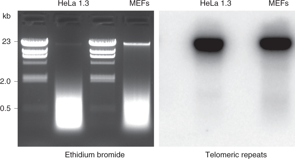 Fig. 3: Example of the bulk DNA and telomere signal migration after the first digestion round with HinfI and MspI.
