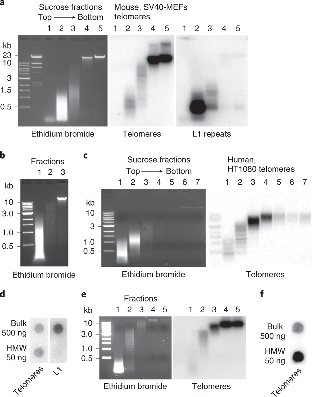 Fig. 4: Separation of the digested DNA on a sucrose gradient and enrichment of telomeric repeats.