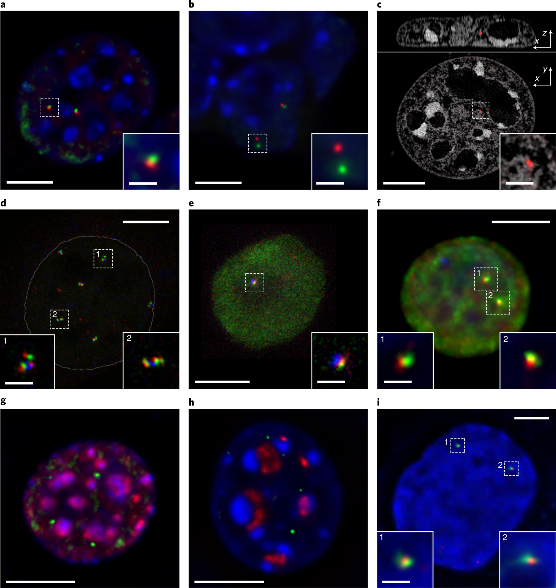 Fig. 6: RASER-FISH hybridization examples with inset magnifications.
