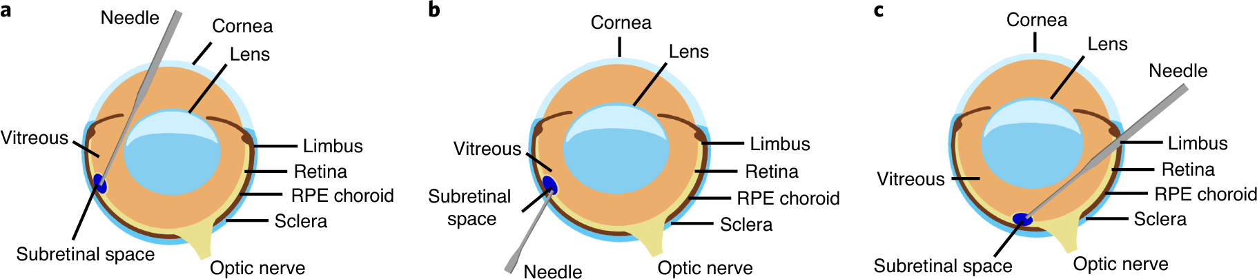 Fig. 2: Depictions of three SRI approaches.