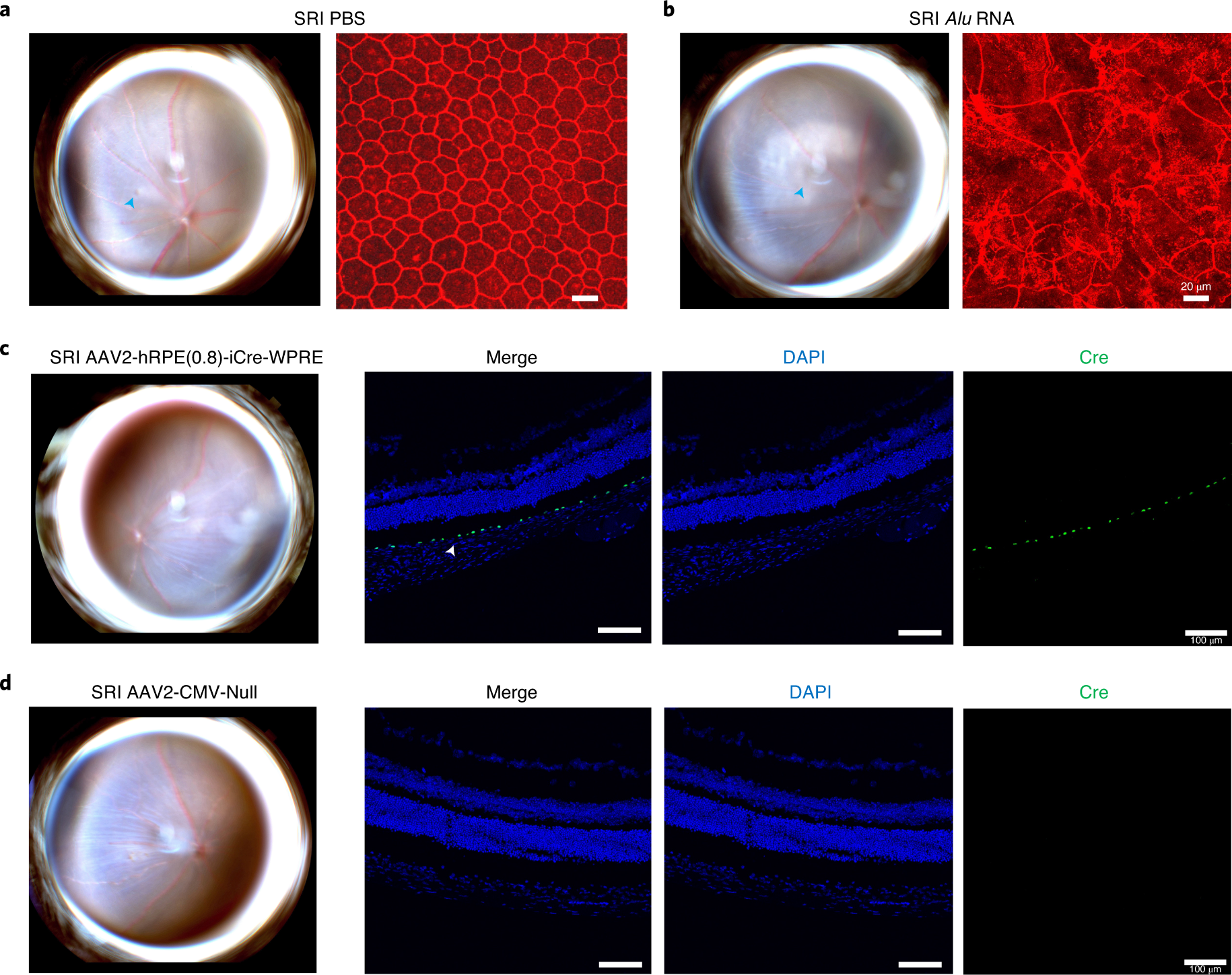 Fig. 5: Representative images of a successful SRI.