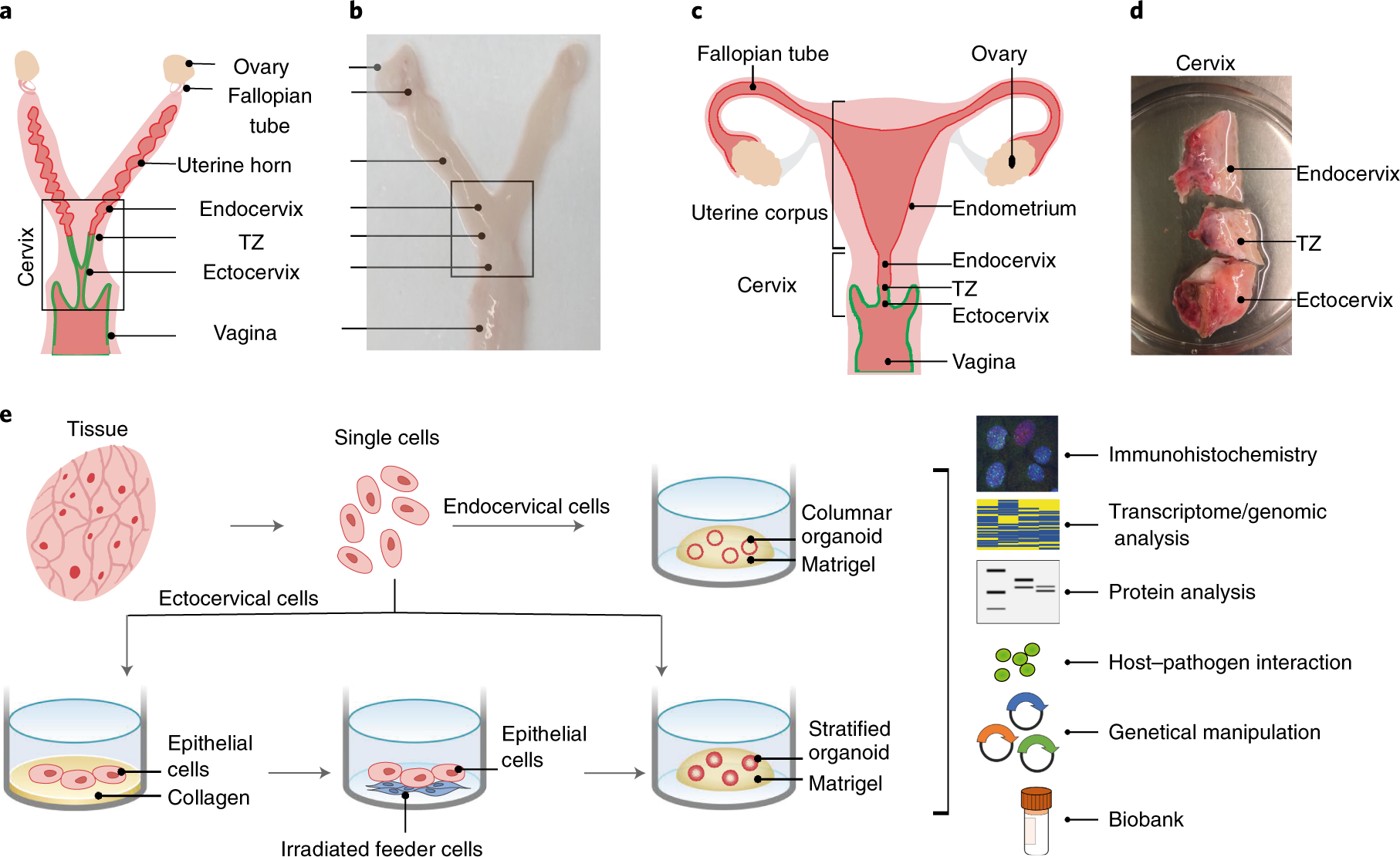 Fig. 1: Schematic representation of endo-ectocervical stem cell isolation, organoid generation, cultivation and characterization.