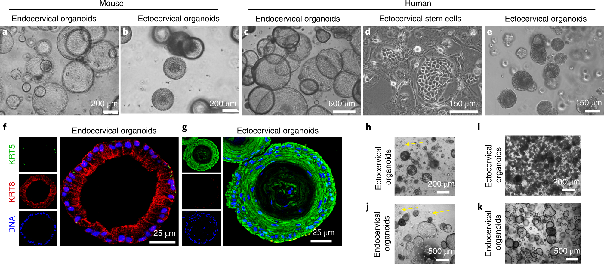 Fig. 2: Human and mouse endo-ectocervical organoids.
