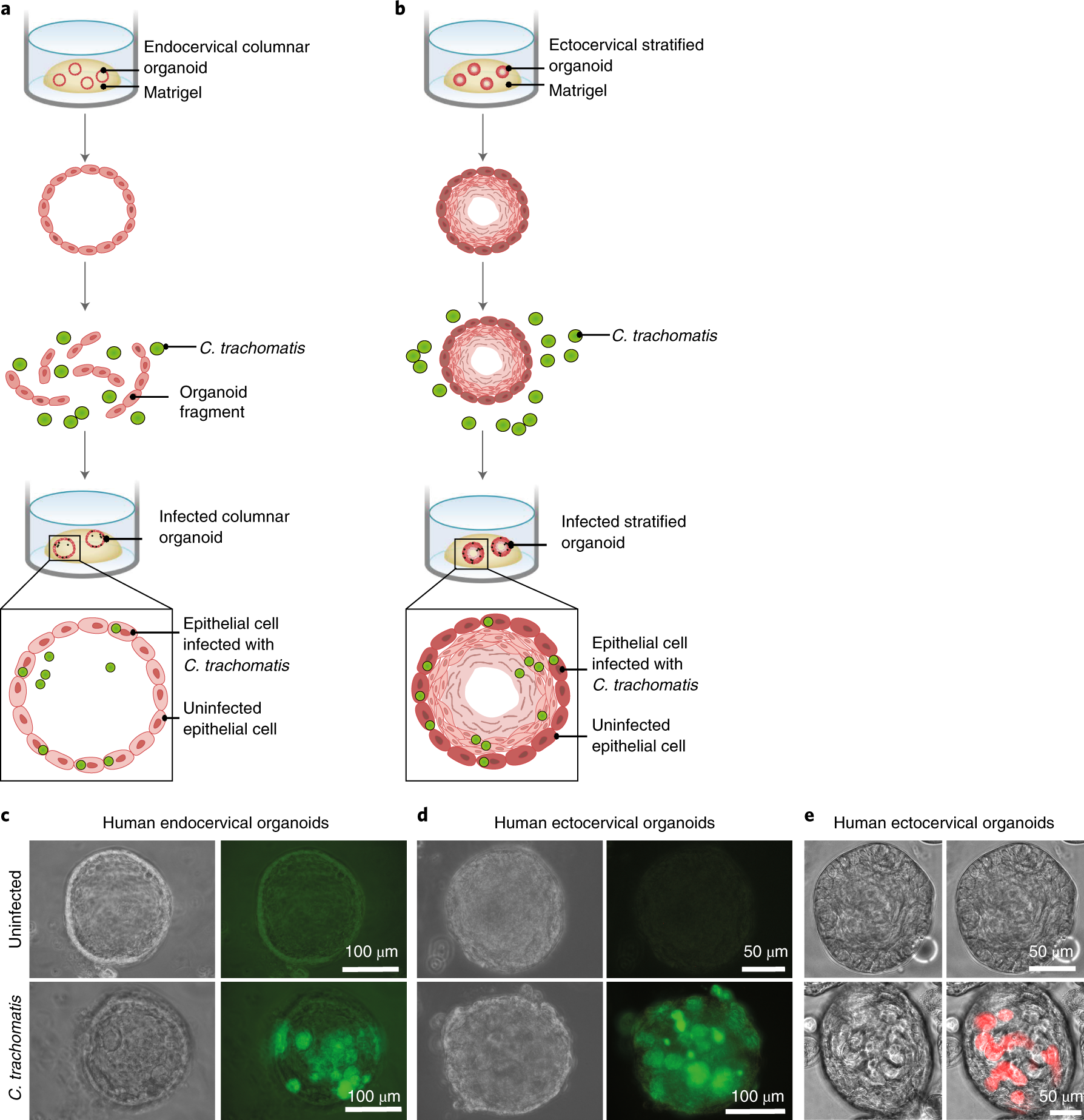 Fig. 4: Chlamydia trachomatis infections of endocervical and ectocervical organoids.