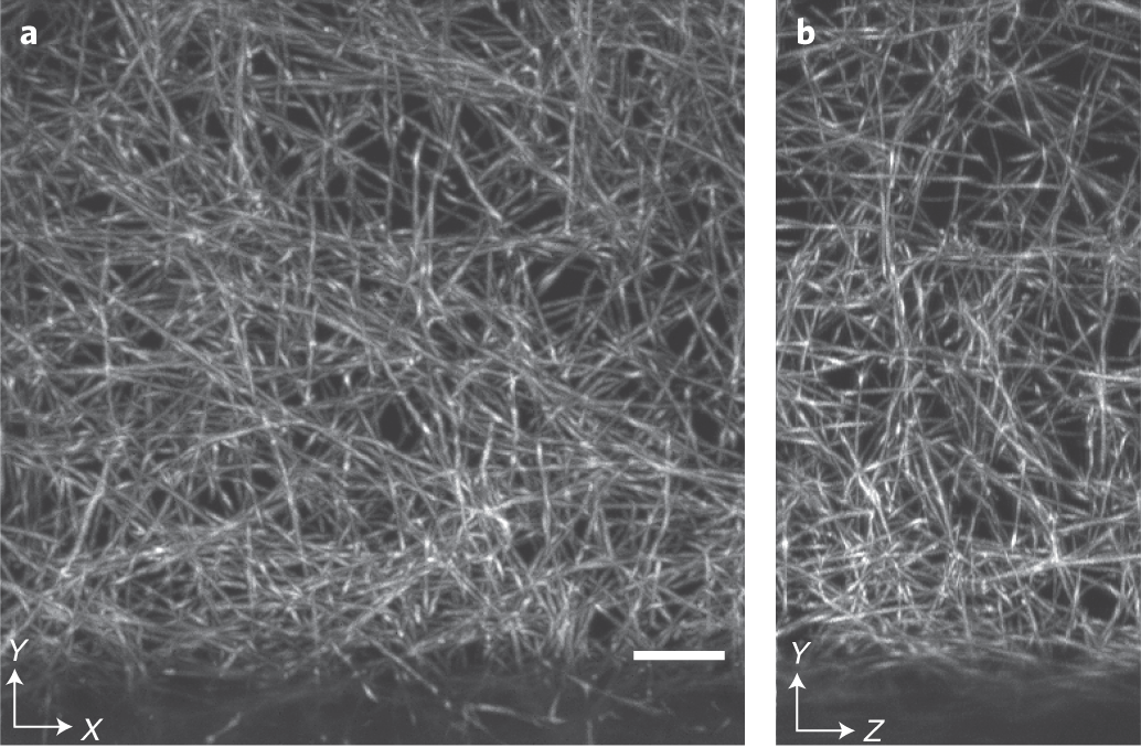 Fig. 14: ASLM imaging of a fluorescent collagen sample.