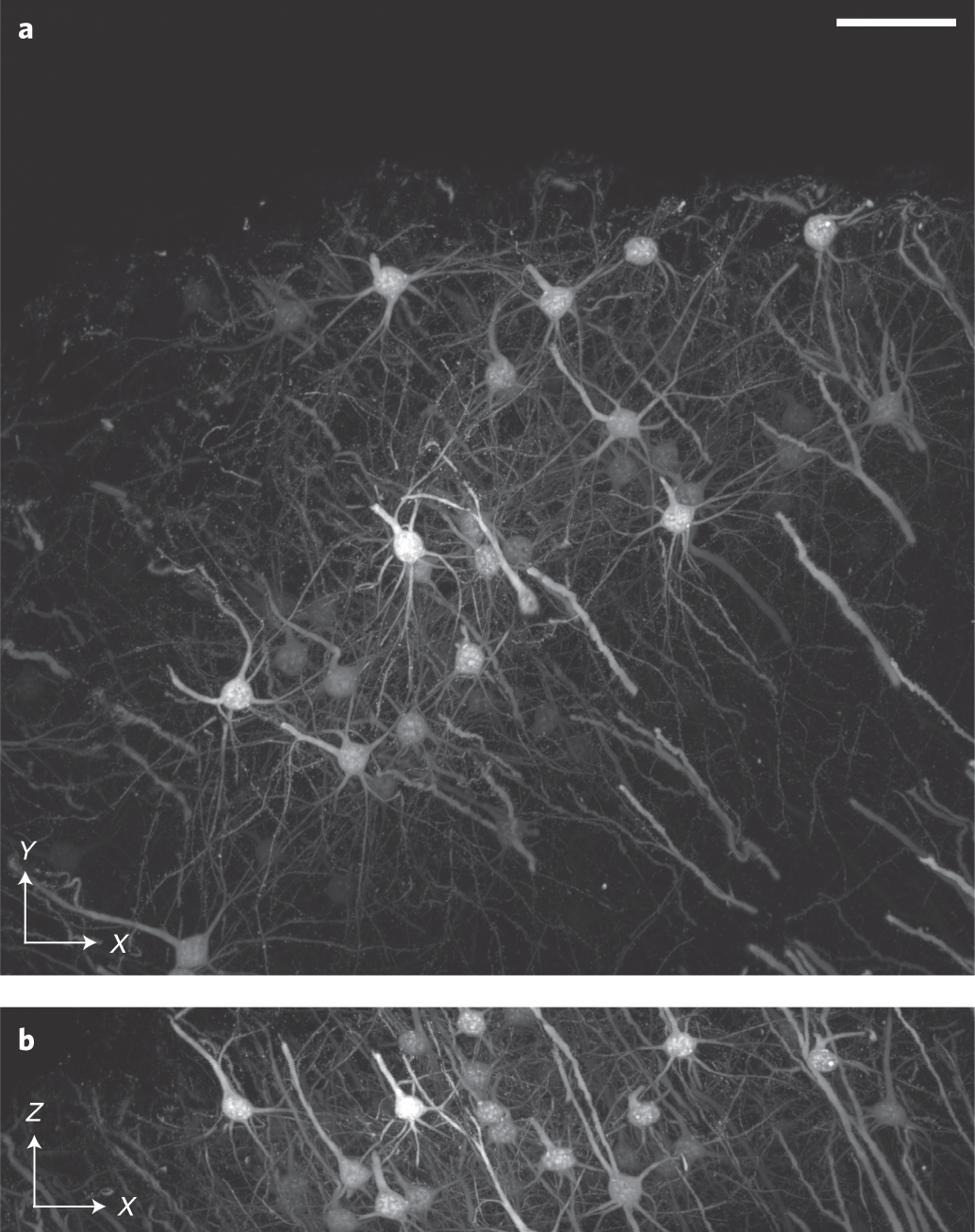 Fig. 15: ASLM imaging of a cleared mouse brain sample.