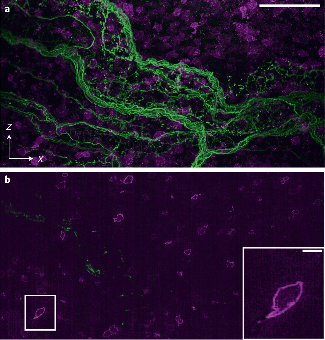 Fig. 16: ASLM imaging in a BABB cleared mouse bone marrow sample.