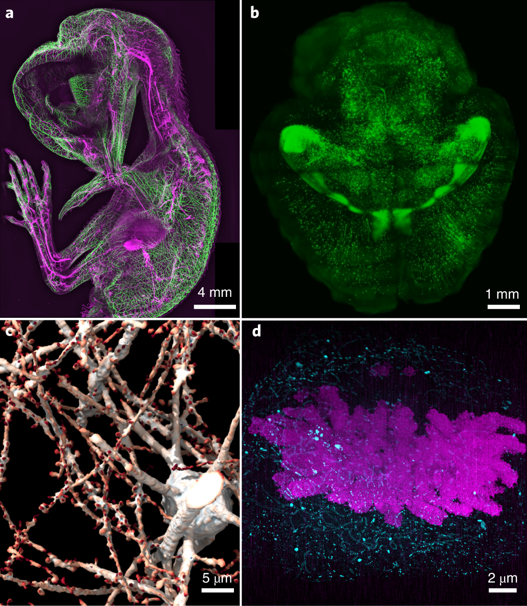 Fig. 2: Multiscale imaging with ASLM.