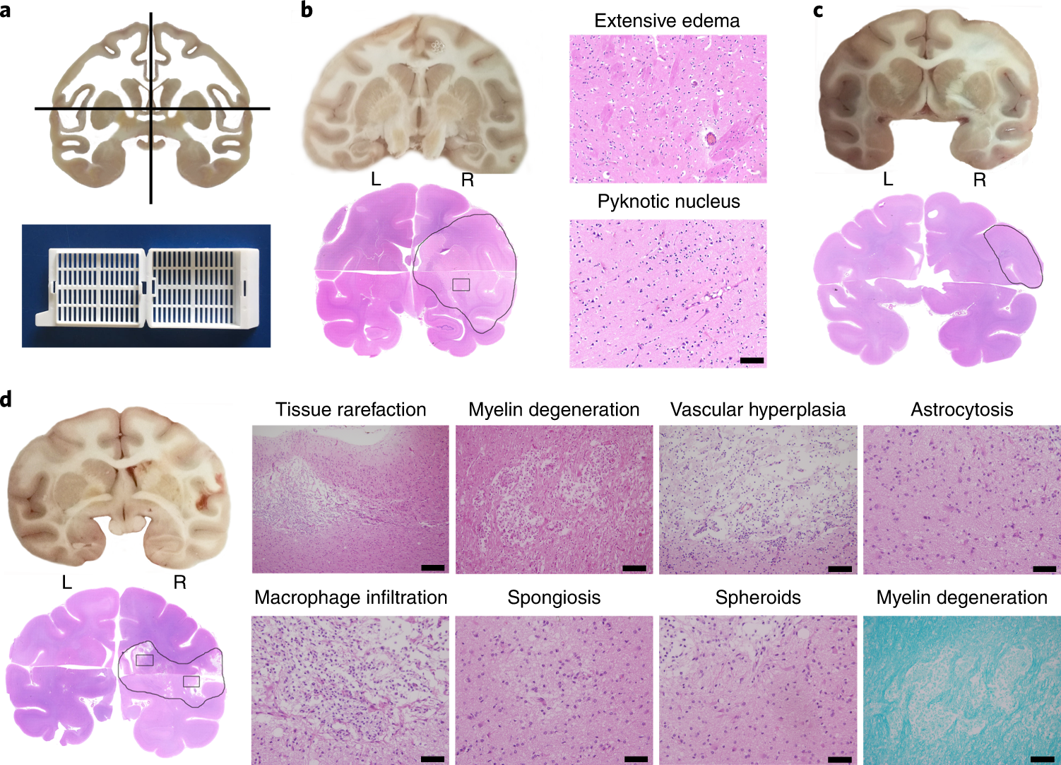 Fig. 8: Biopsy and histopathological analysis.