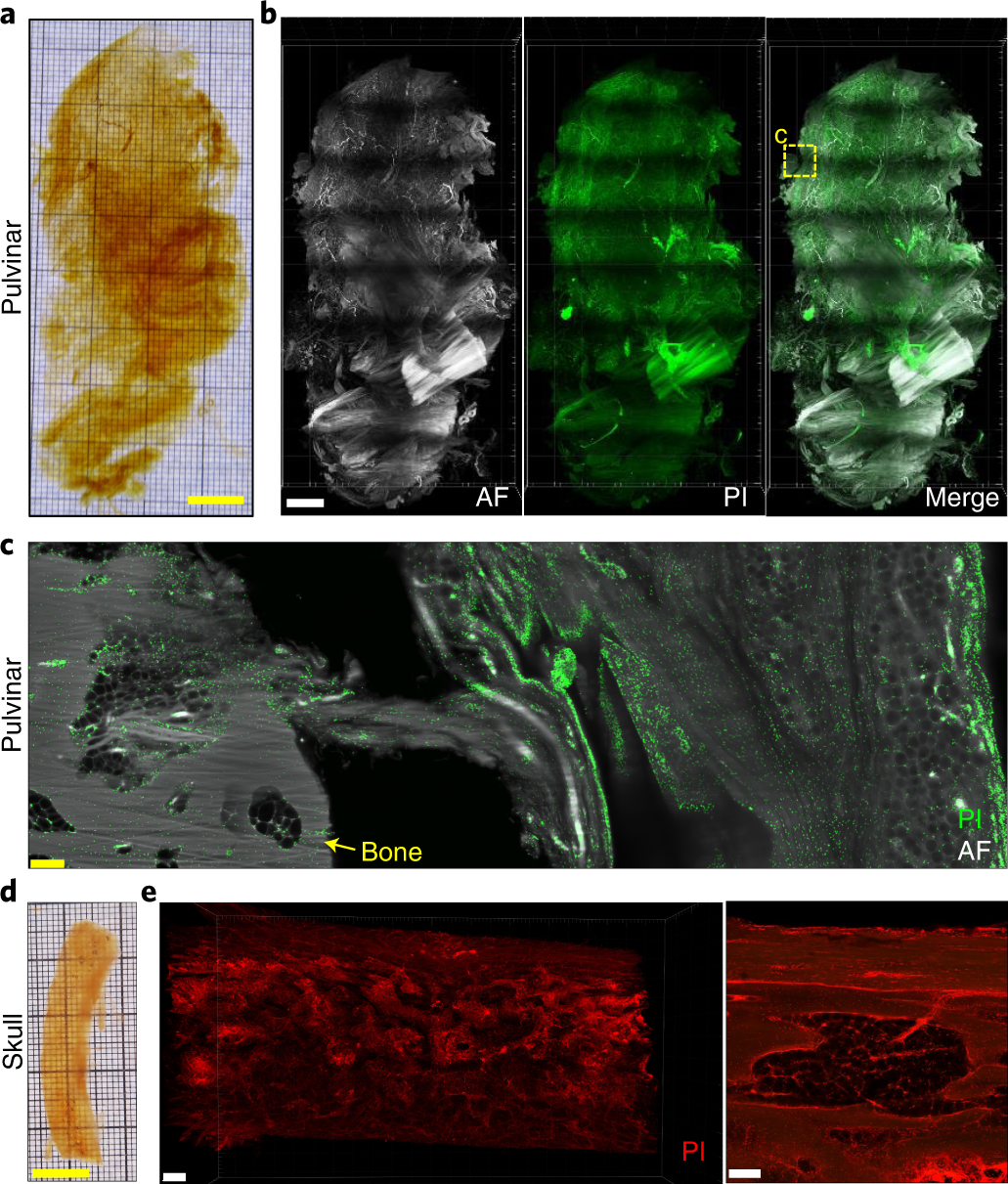 Fig. 7: Passive incubation, clearing and 3D reconstruction of human pulvinar and skull.