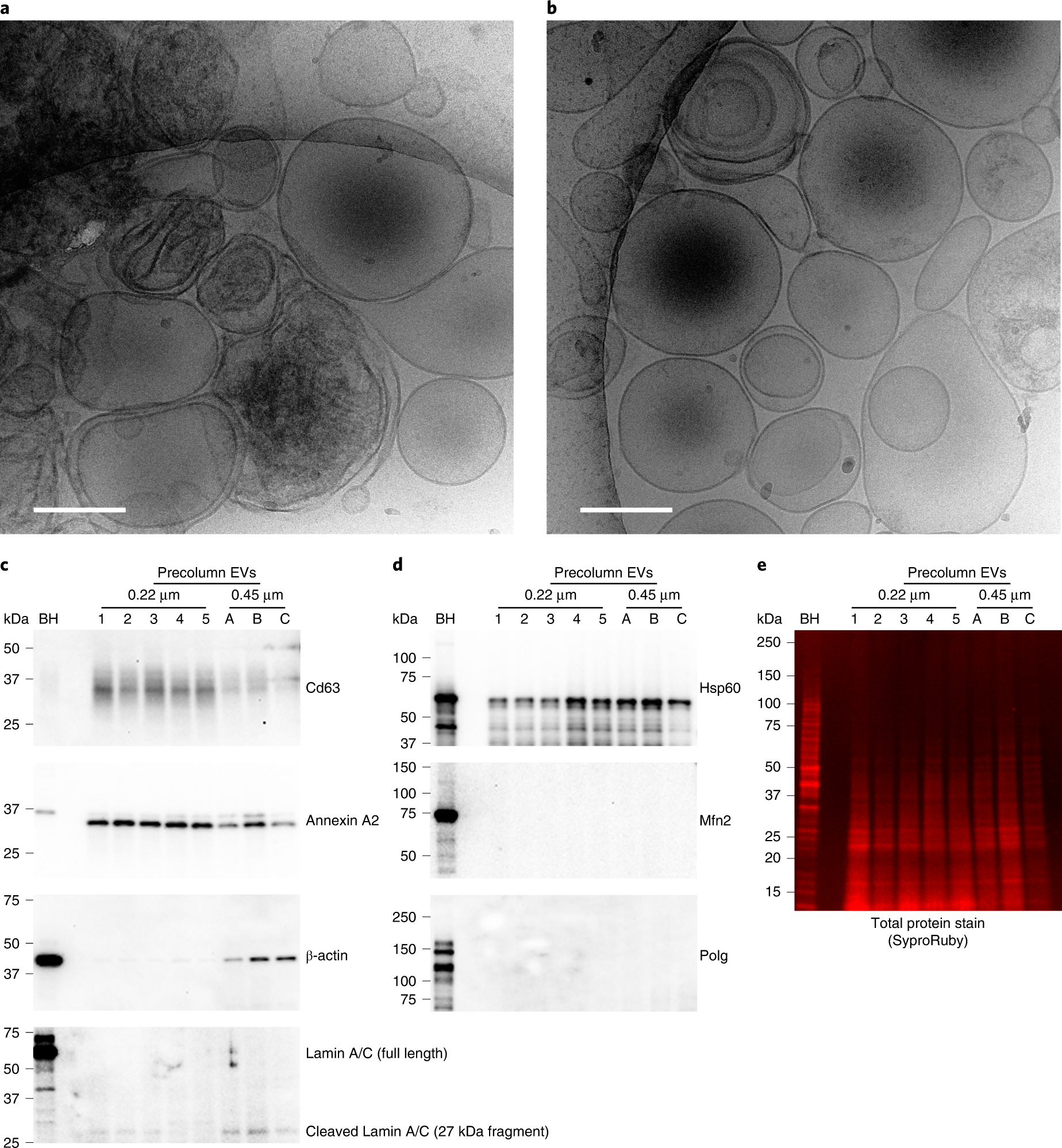 Fig. 2: A 0.22 µm filtration step is crucial for EV quality and yield.