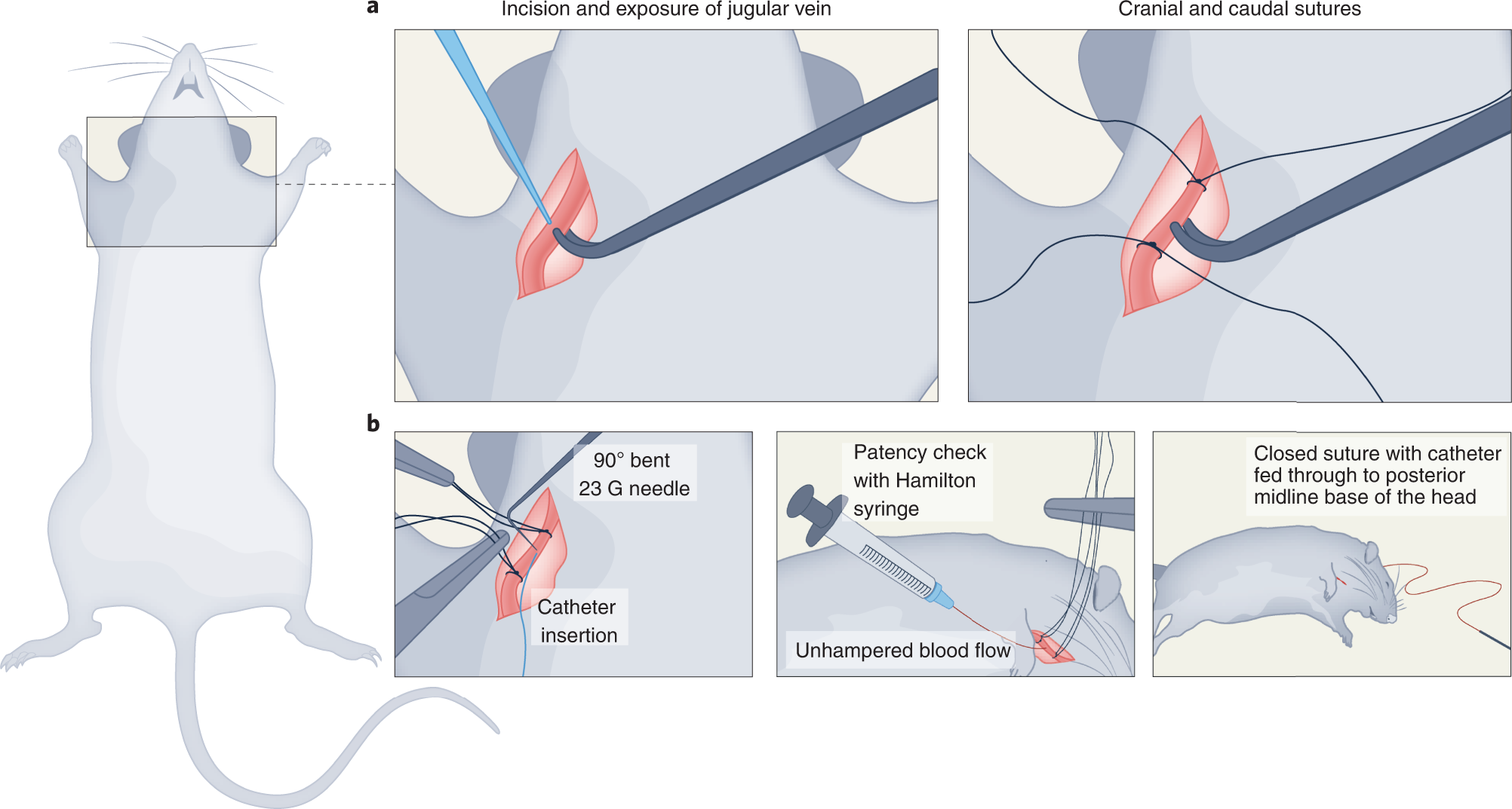 Fig. 3: Major stages of jugular vein cannulation procedure (tracing of the photographs).