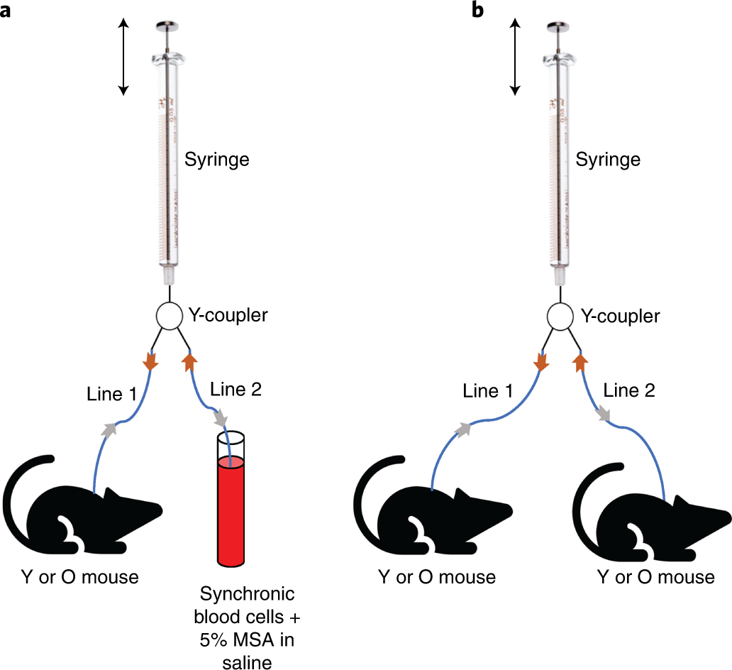 Fig. 5: Back-and-forth blood exchanges using the Y-coupler and syringe method.