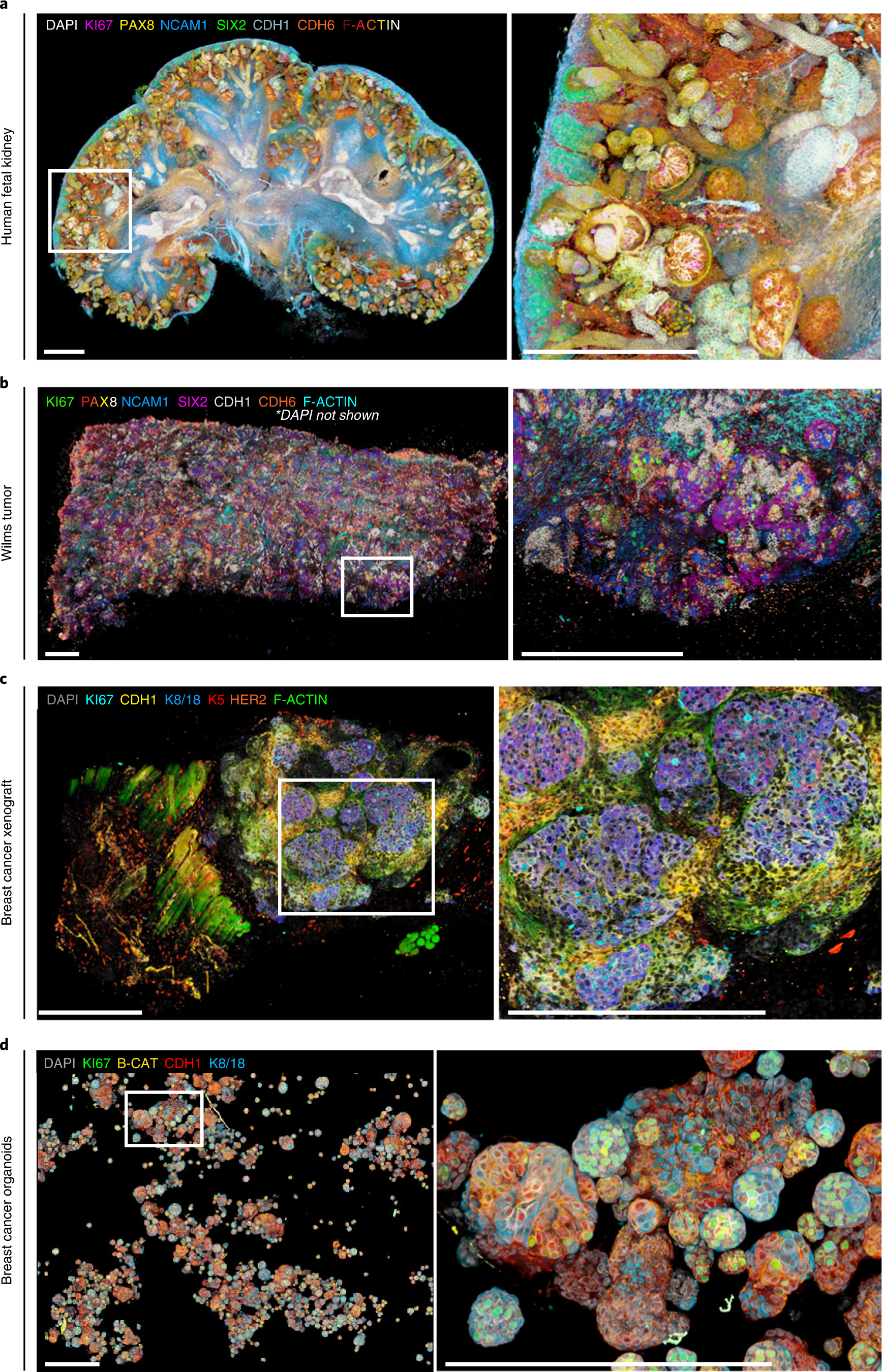Fig. 3: mLSR-3D imaging of fetal kidney, Wilms tumor, breast cancer xenograft and organoids.