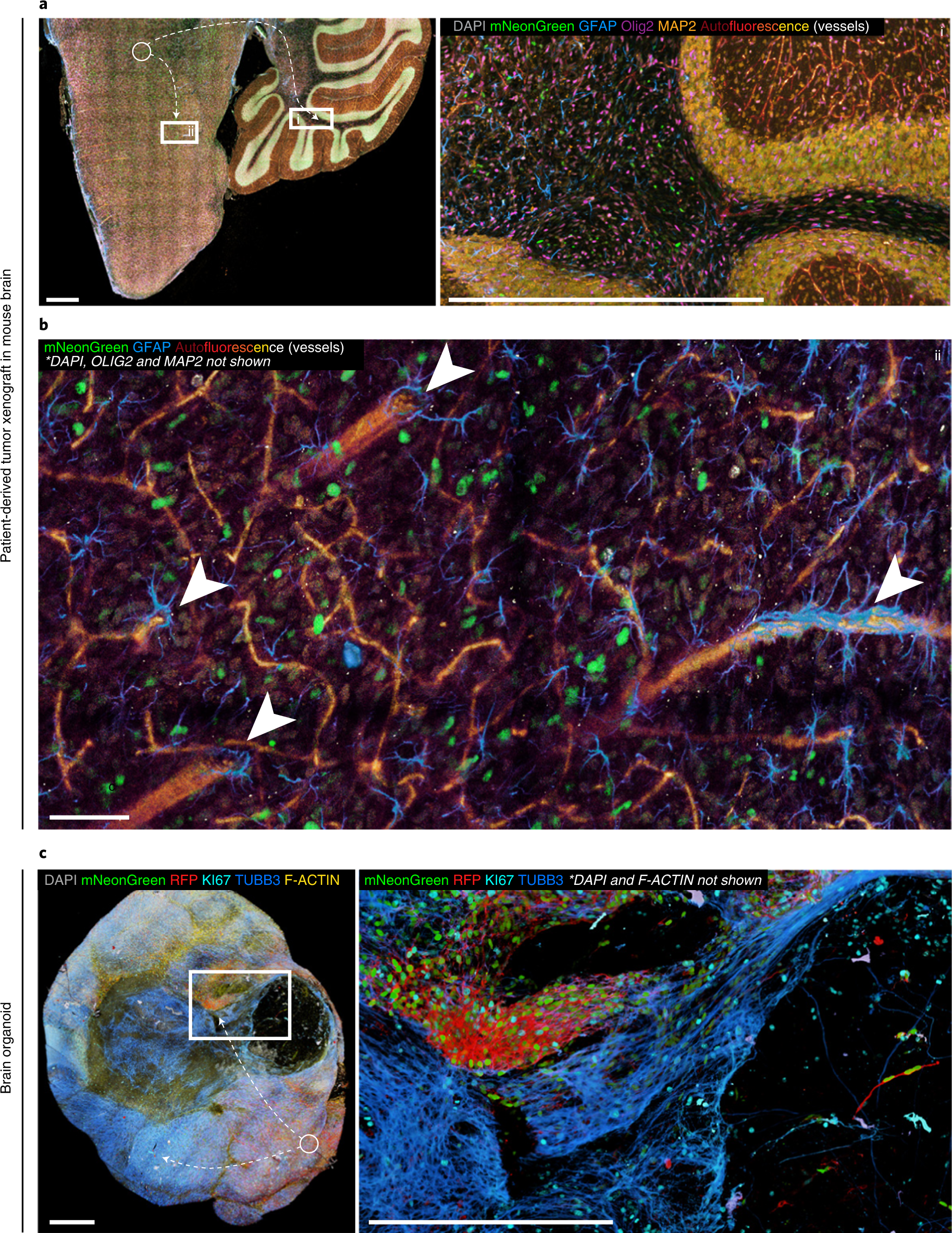 Fig. 4: mLSR-3D imaging of brain tissue and organoids.