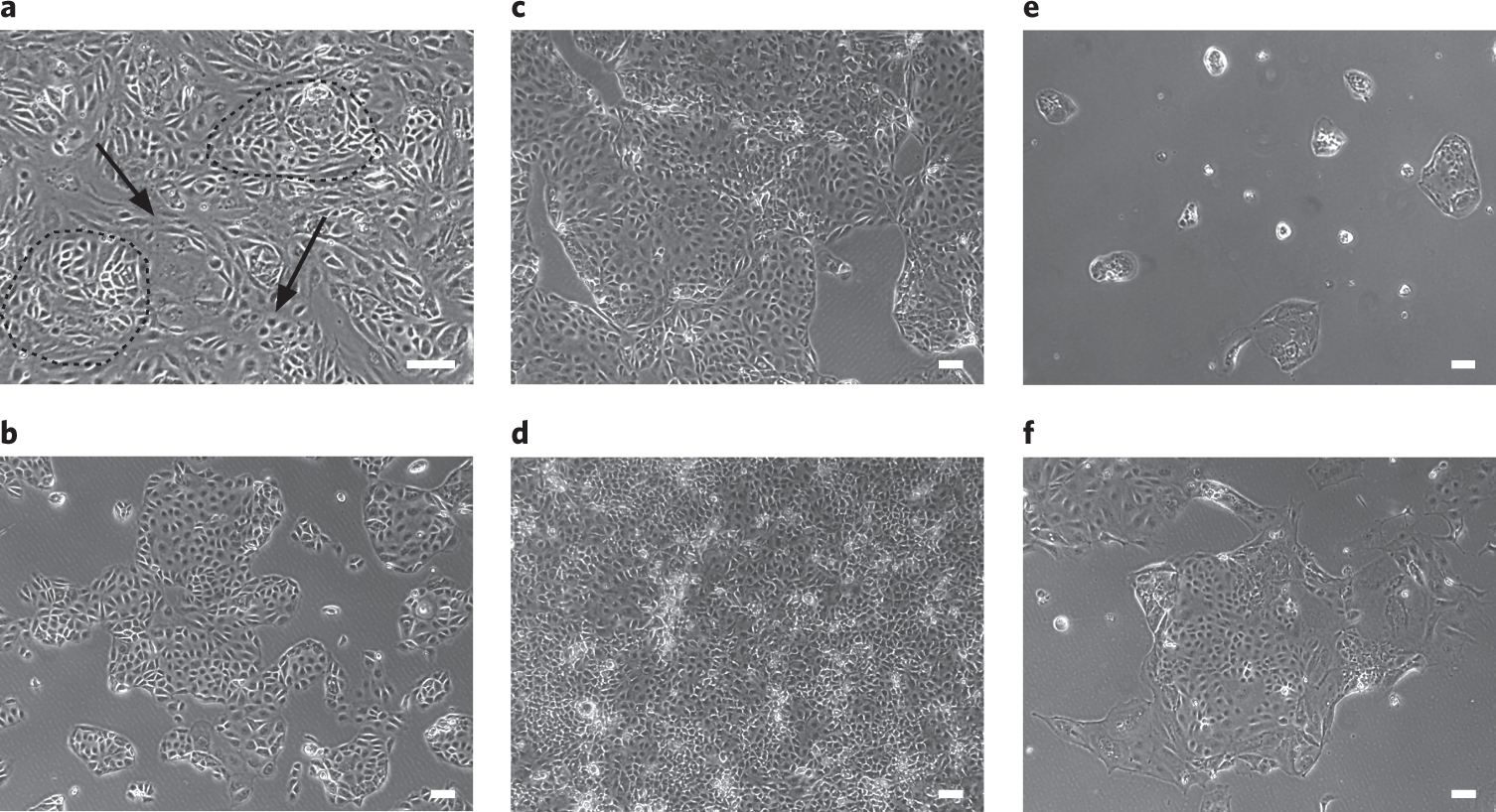 Fig. 3: Routine maintenance of iTS cells.
