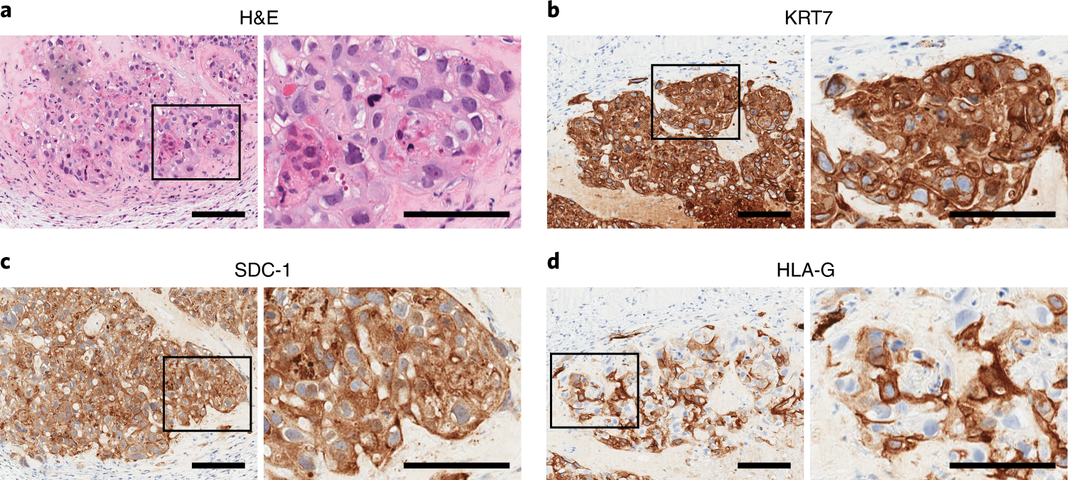 Fig. 6: In vivo engraftment assay of iTS cells into NOD/SCID IL-2R-gamma knockout mice.