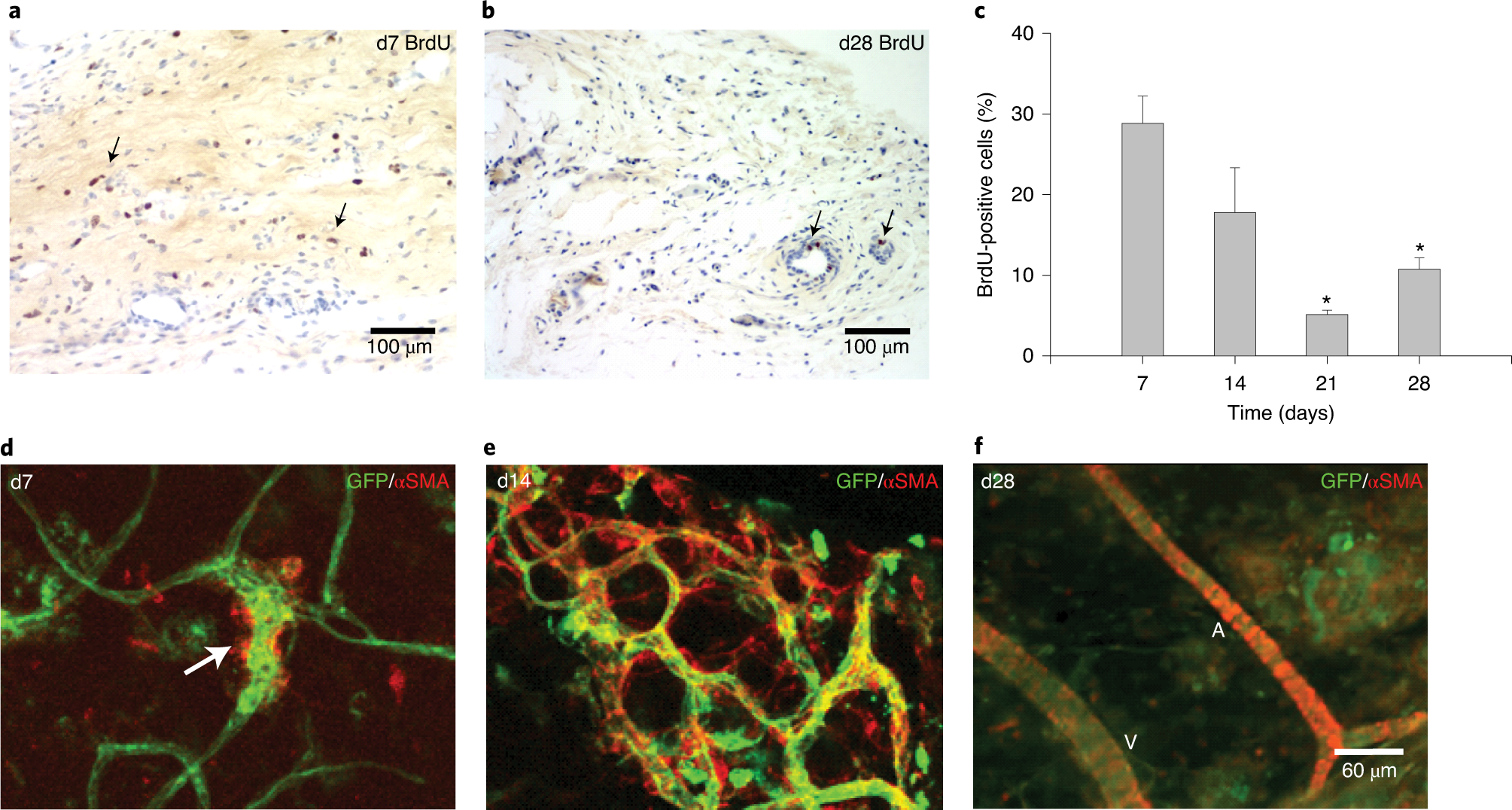 Fig. 4: Neovascular progression in subcutaneously implanted MV grafts.