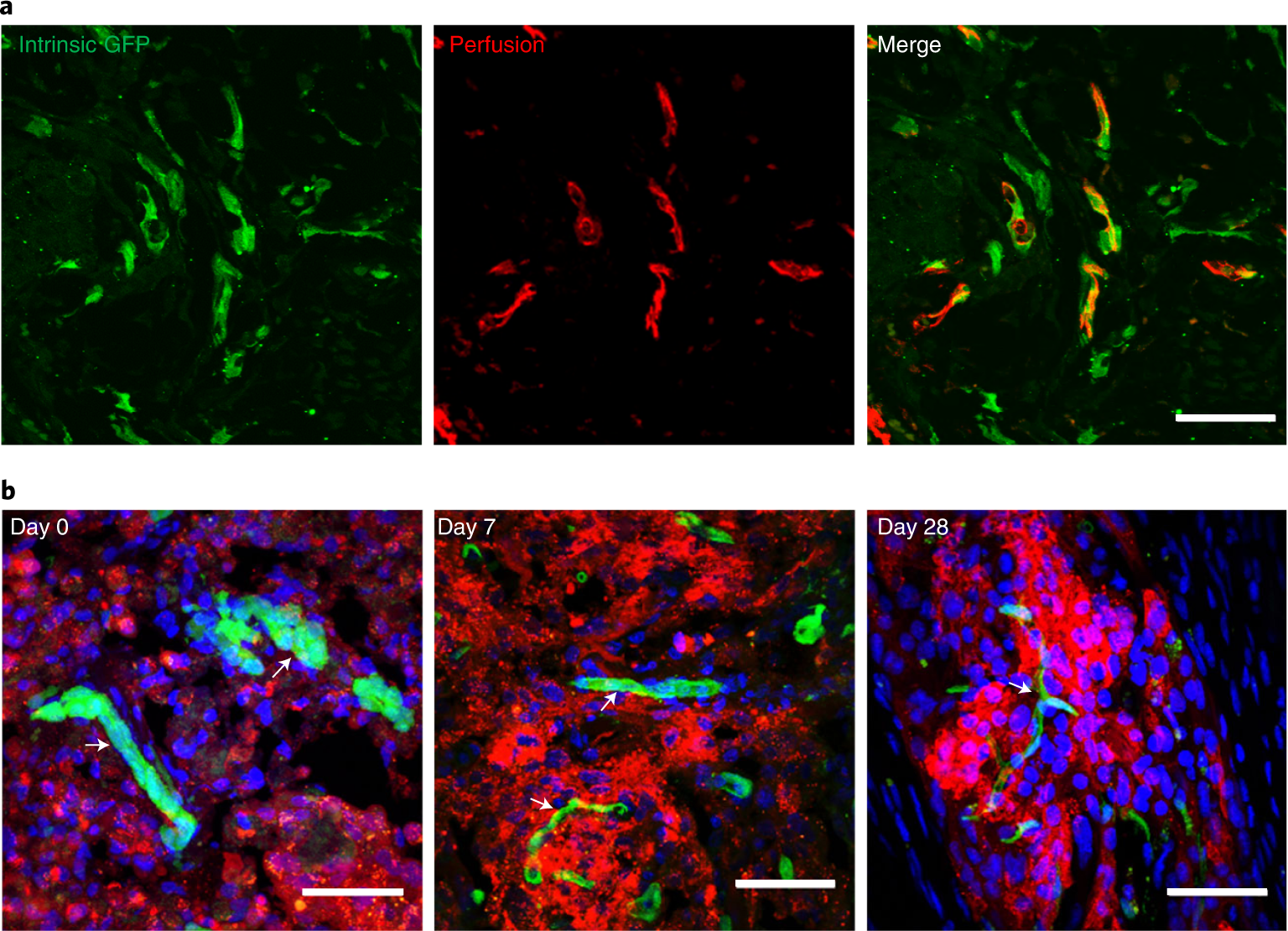 Fig. 6: Ready-made MVs get perfused early and persist long term, integrating into the cardiac vasculature and forming stable grafts.