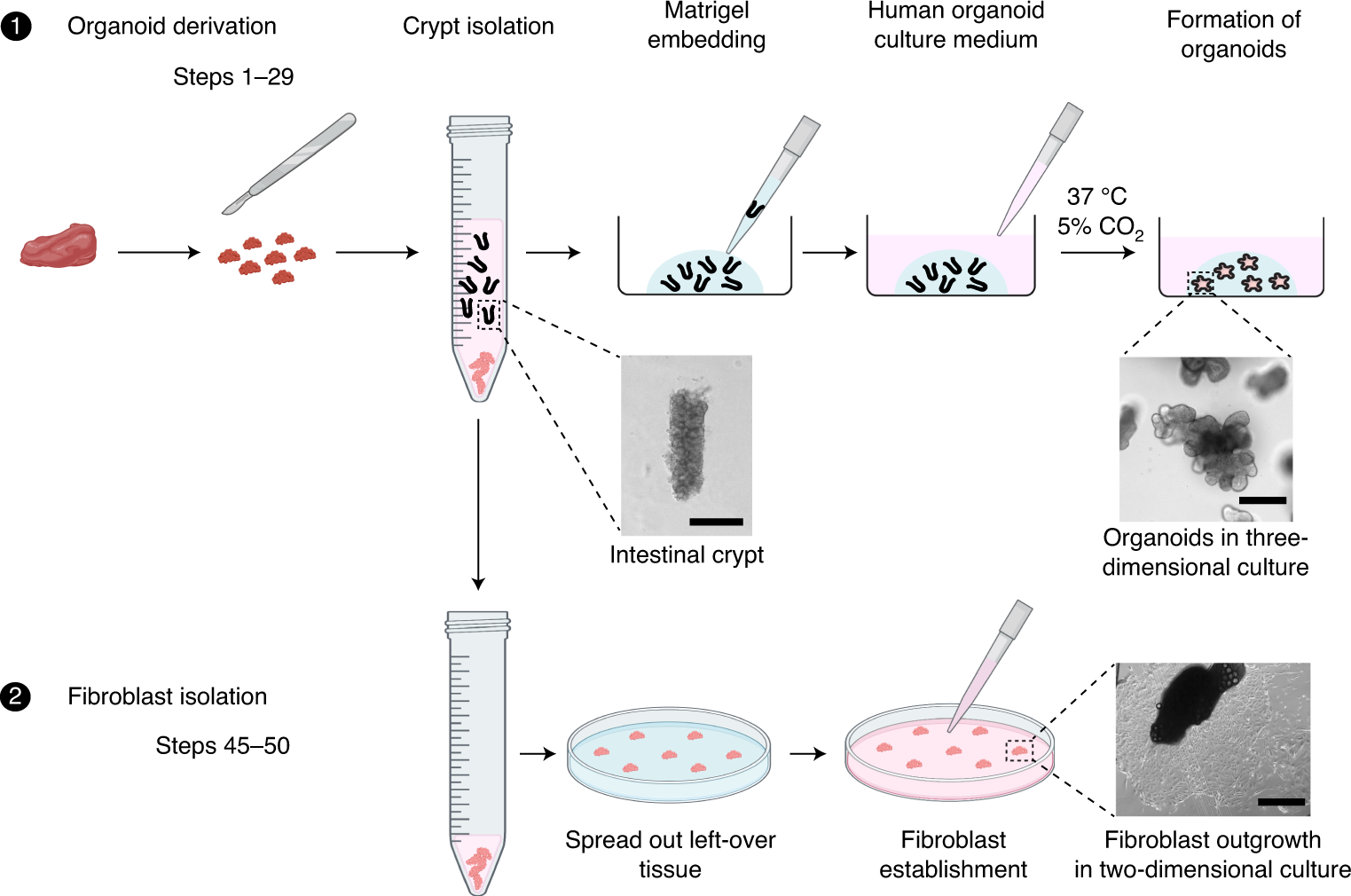 Fig. 2: Derivation and expansion of patient-derived intestinal organoids and fibroblasts.