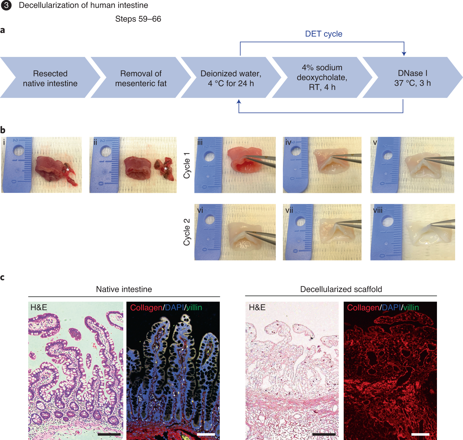 Fig. 3: Generation of decellularized human intestinal scaffolds.