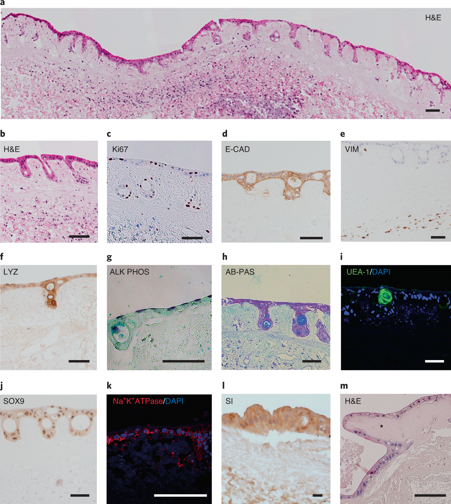 Fig. 6: Characterization of the human intestinal mucosal grafts.