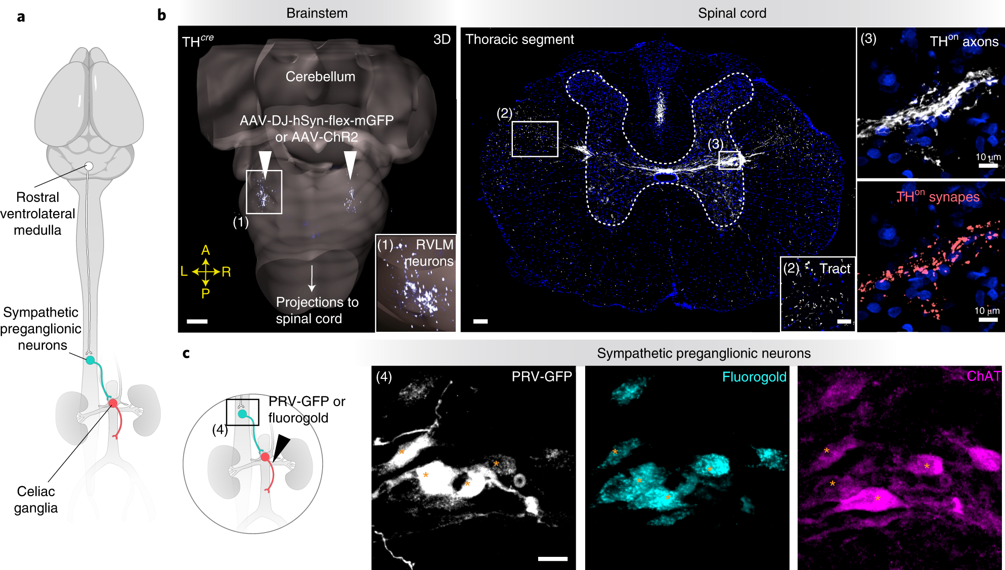 Fig. 10: Anticipated results for Procedures 4 and 5.