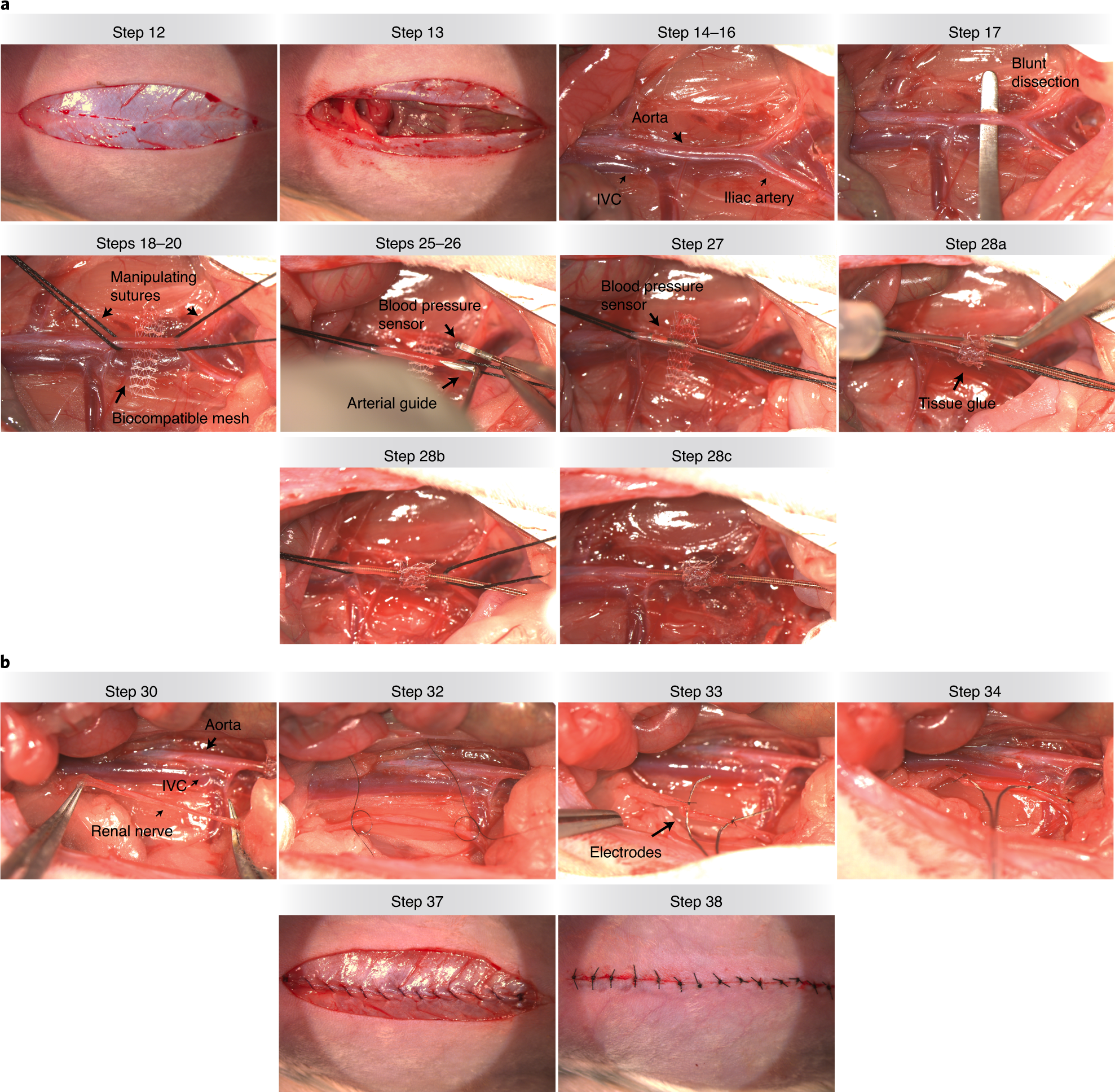 Fig. 2: Surgical approach to the implantation of chronic blood pressure and renal sympathetic nerve recordings: Procedure 1.