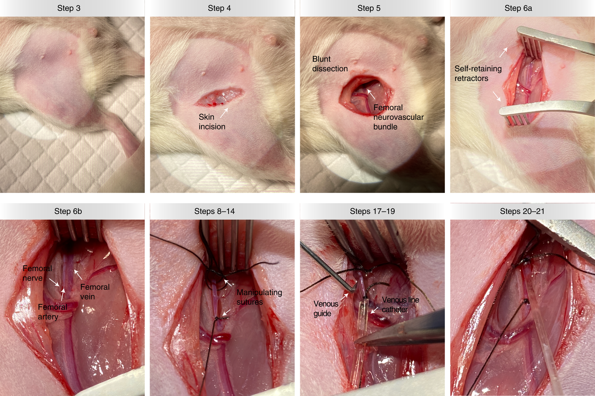 Fig. 4: Femoral vein catheterization: Procedure 3.