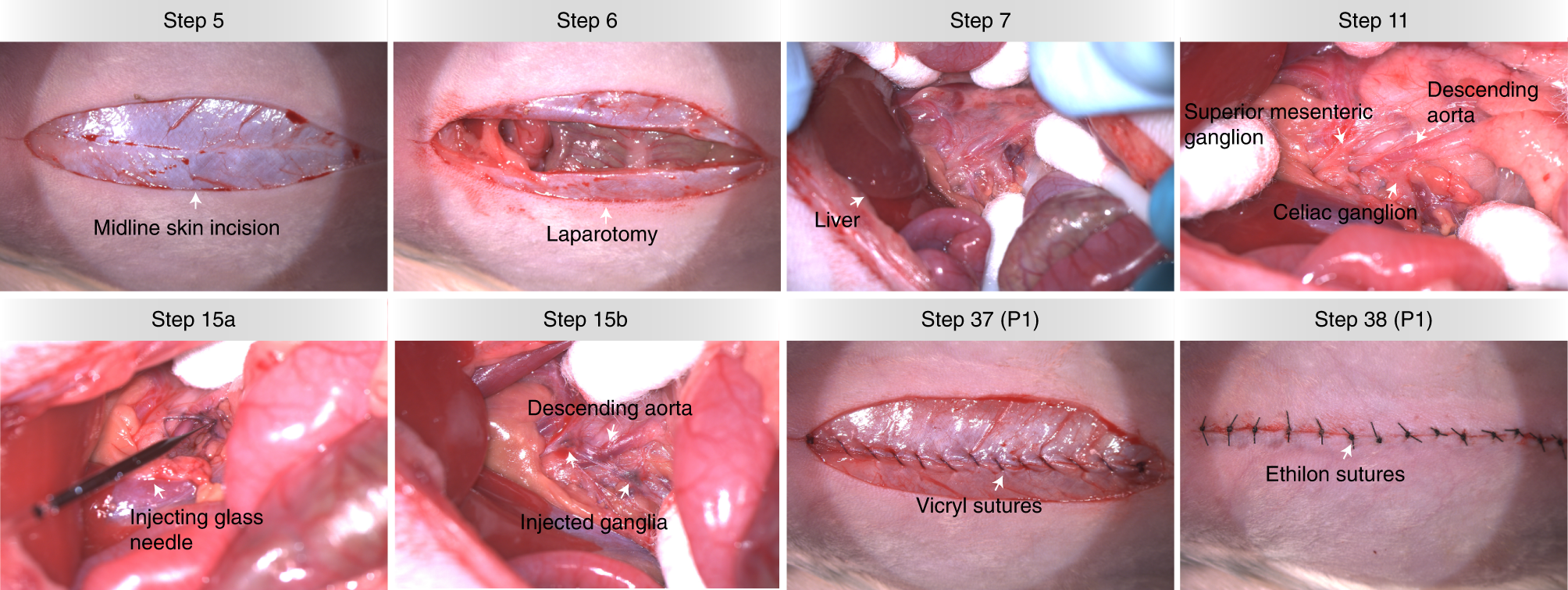 Fig. 5: PRV viral injections into the splanchnic ganglia: Procedure 4.