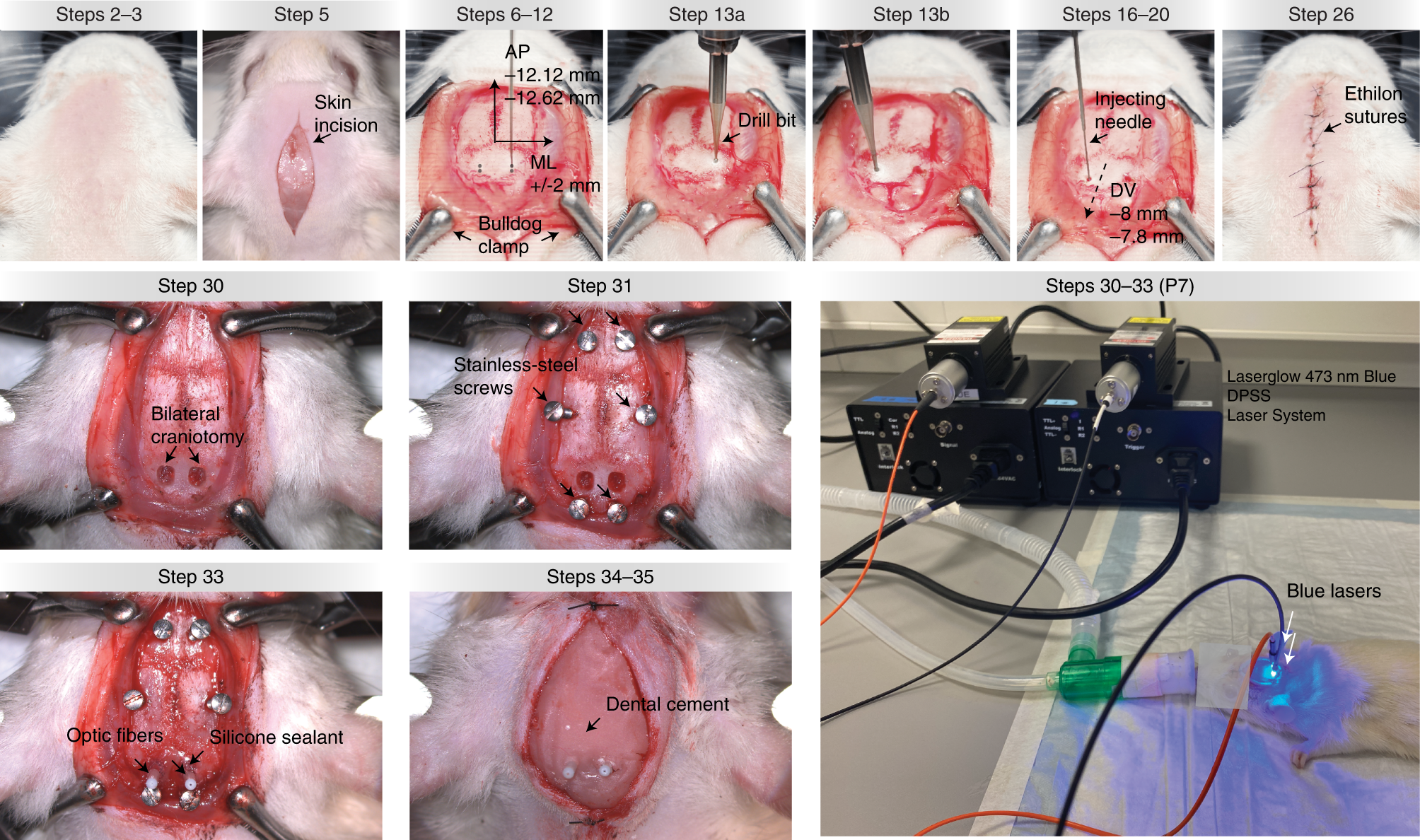 Fig. 6: Viral tract tracing and optogenetic manipulation of descending sympatho-excitatory axons from the rostral ventrolateral medulla: procedure 5.