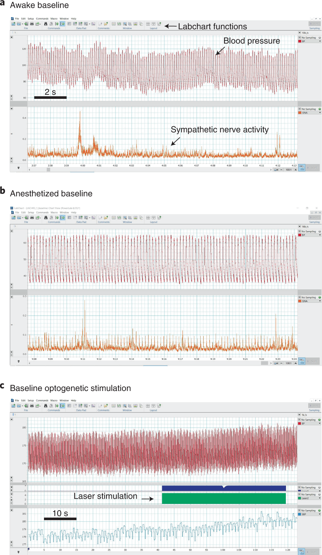 Fig. 7: Awake baseline, anesthetized baseline and (optional) baseline optogenetic stimulation assessments: procedures 5 and 7.