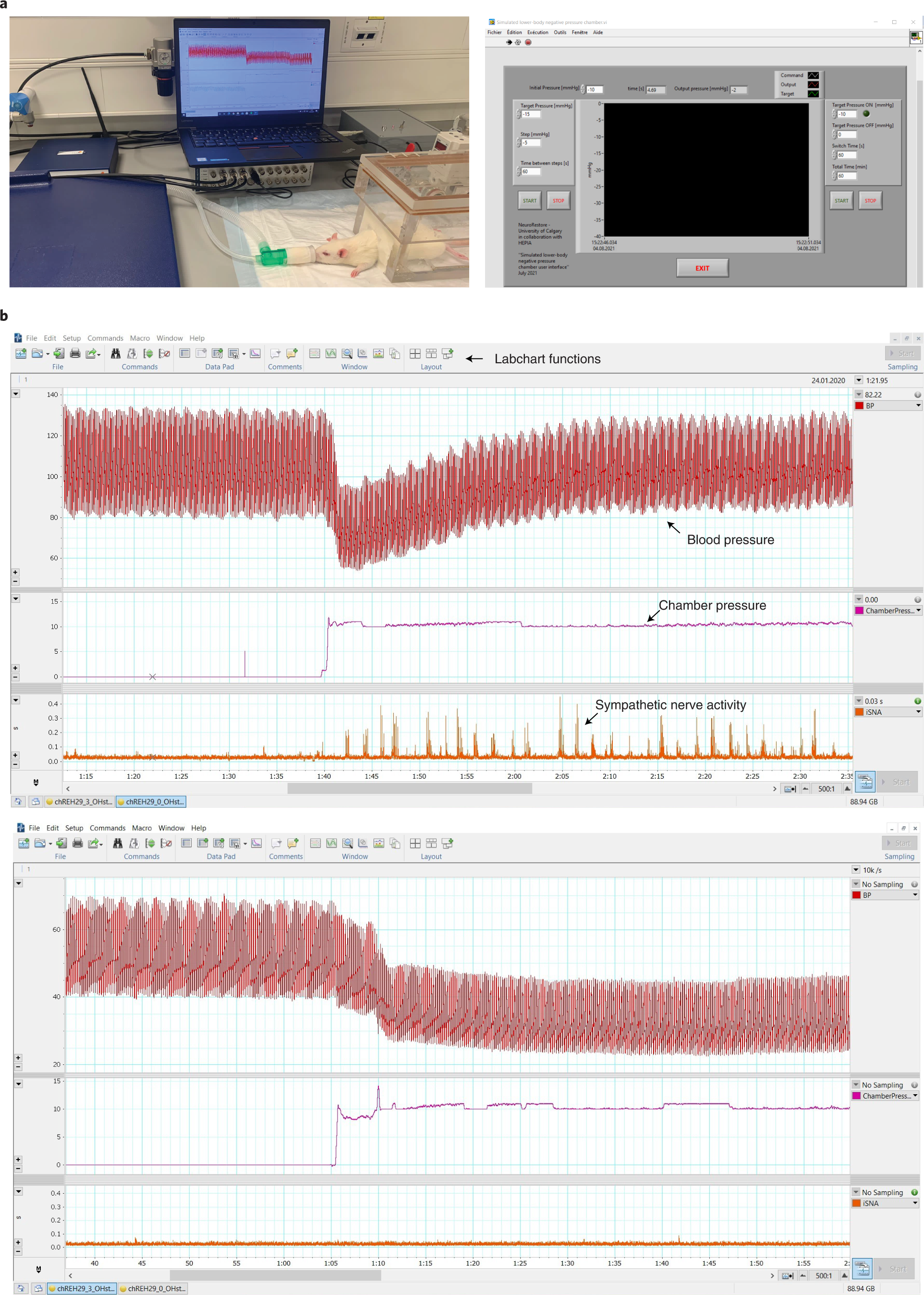 Fig. 8: Lower-body negative-pressure chamber assessment (simulated orthostatic challenge): Procedure 6.