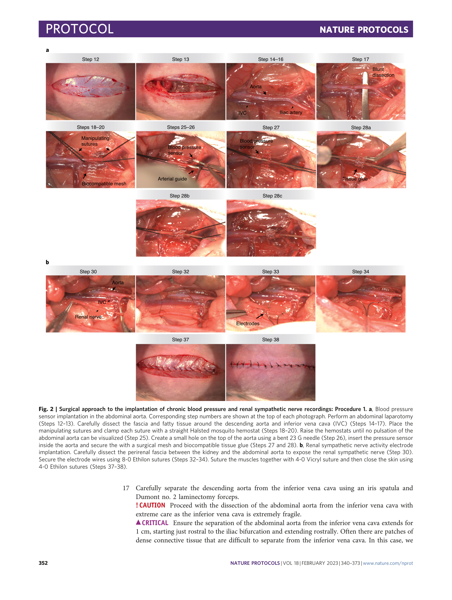 page-13