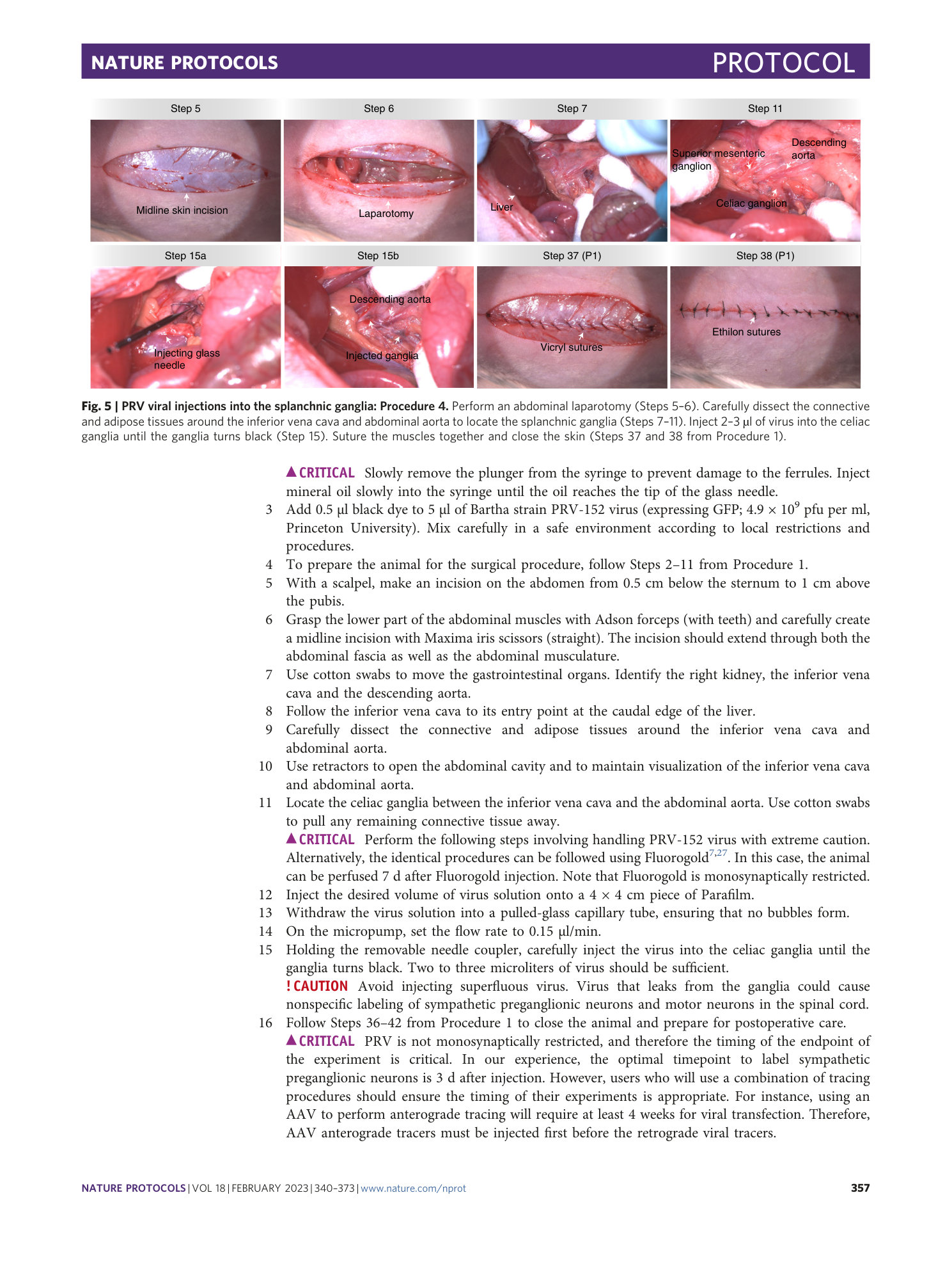 page-18
