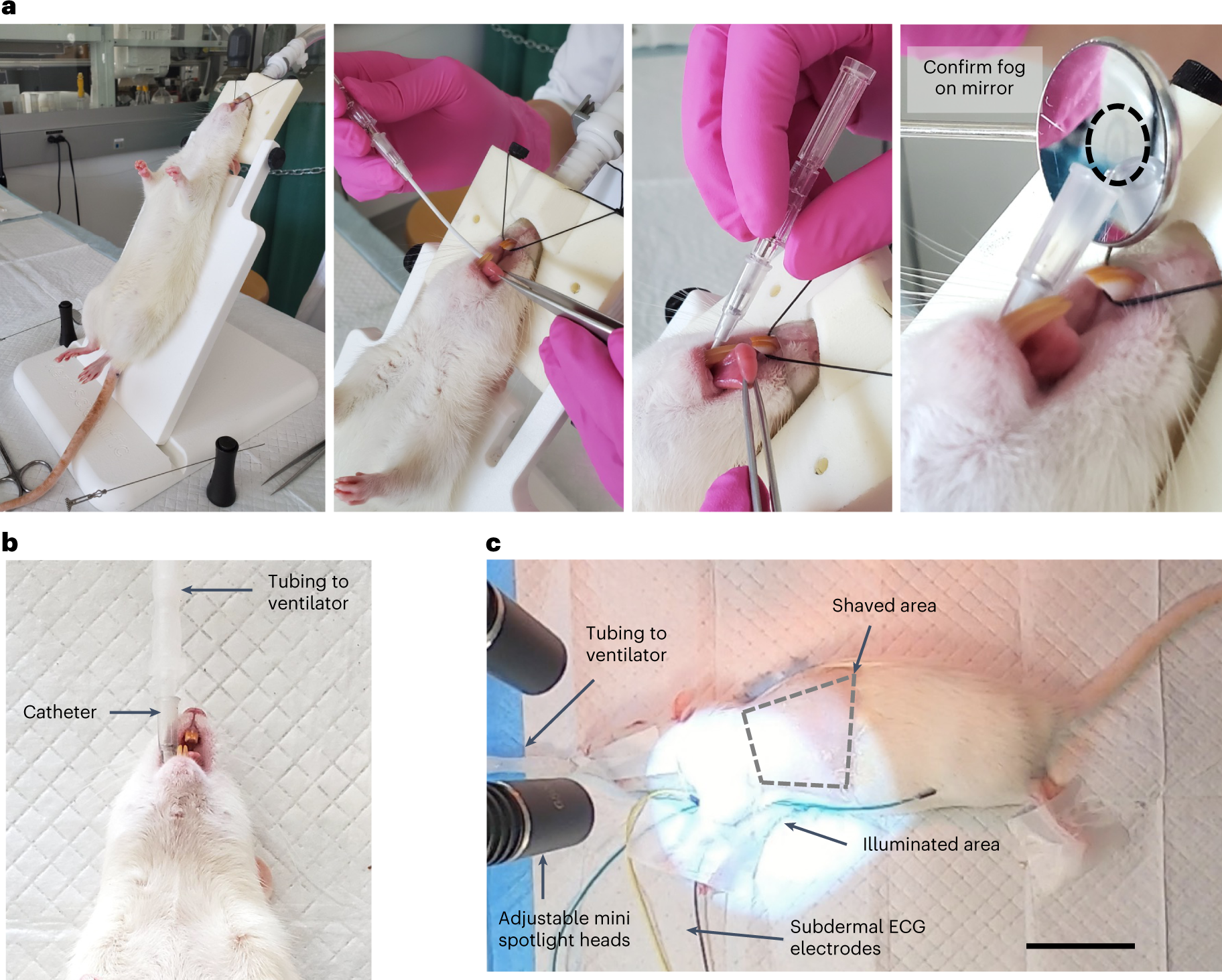 Fig. 3: Intubation technique for open thoracic approach and surgical table preparations before incision.